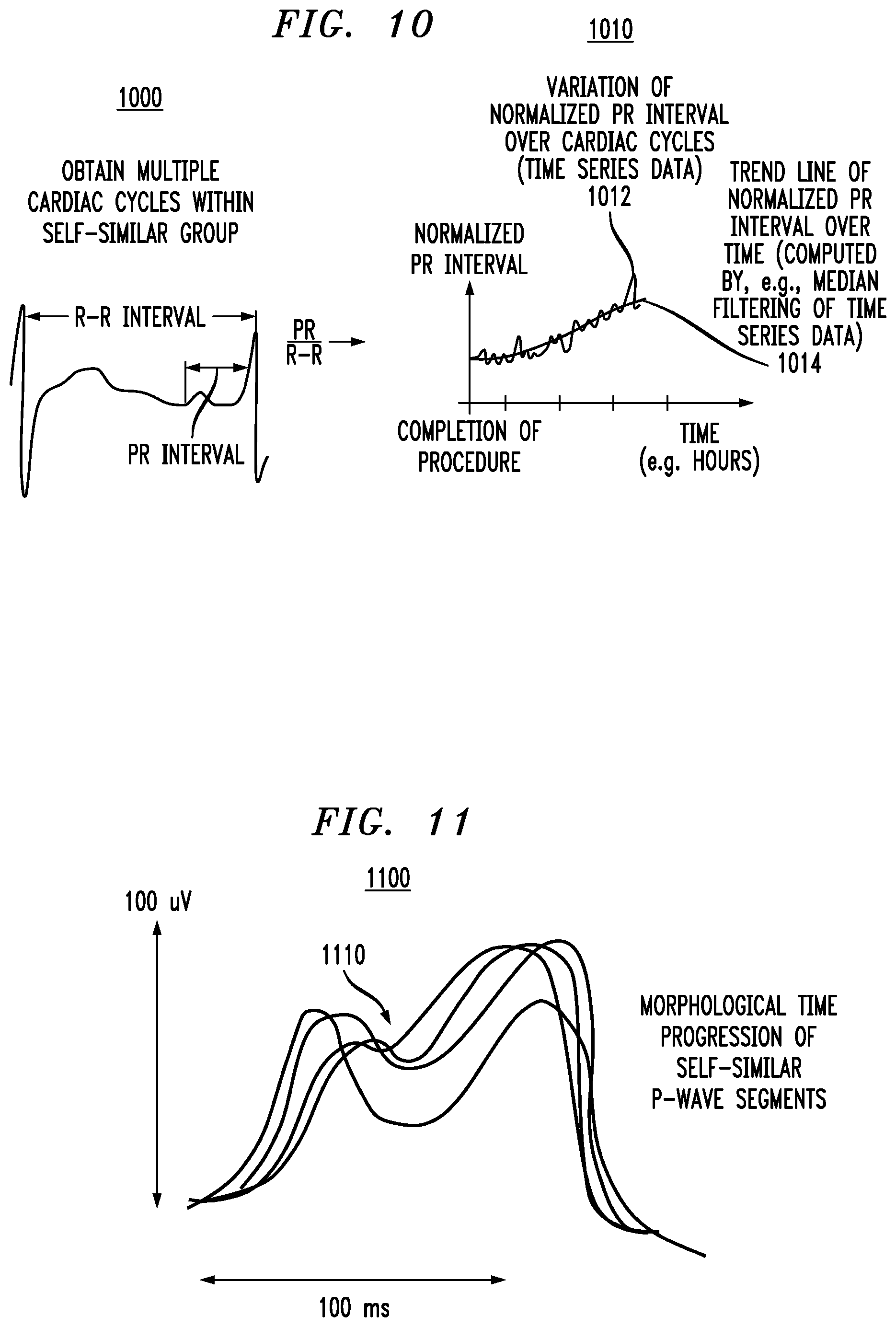 Patent US12310760 Figure 11 – Monitoring and processing physiological signals to detect and predict dysfunction of an anatomical feature of an individual