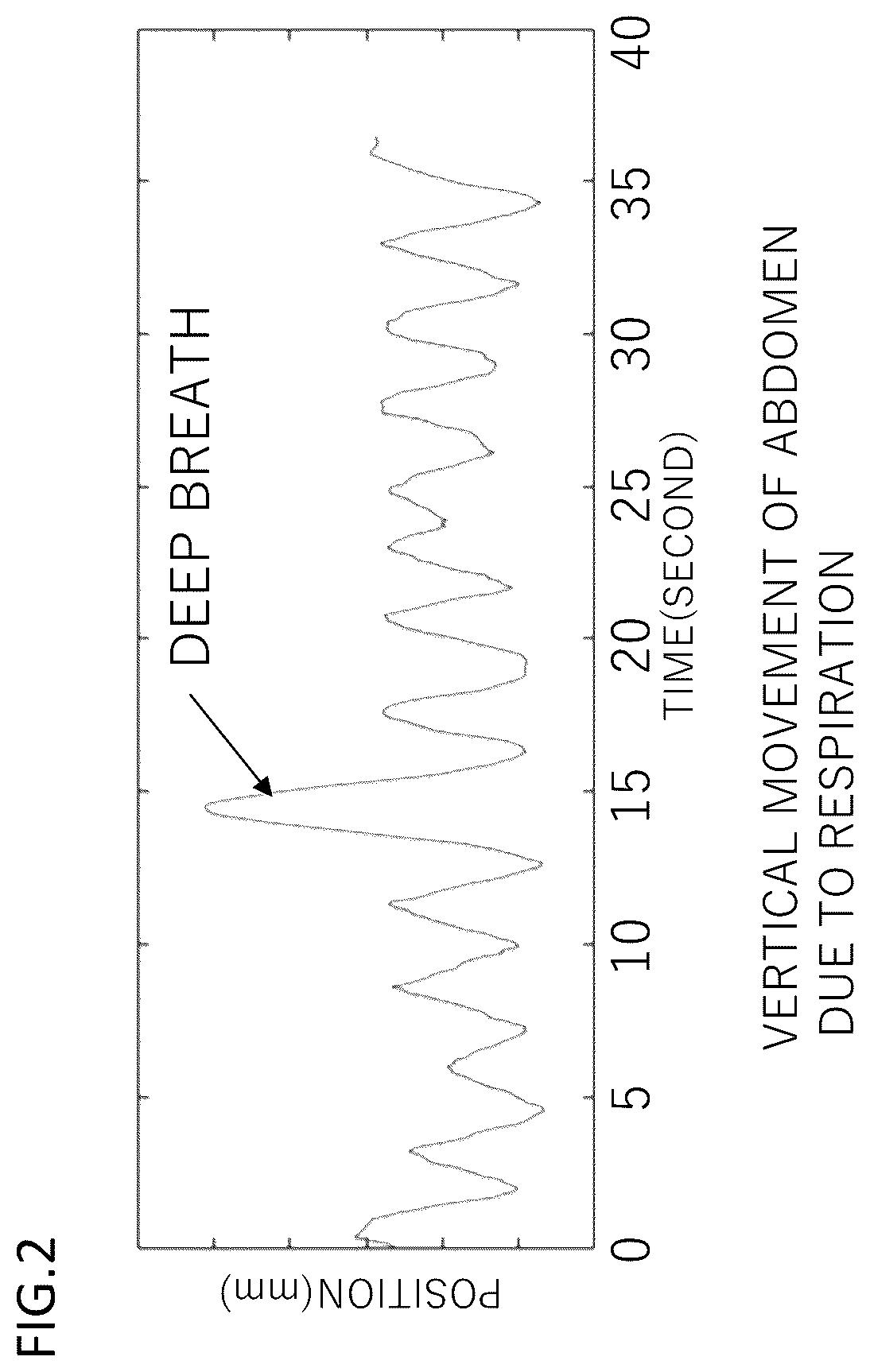 Patent US12310761 Figure 2 – Medical imaging apparatus including biological signal processing system, medical imaging system, and biological signal processing method