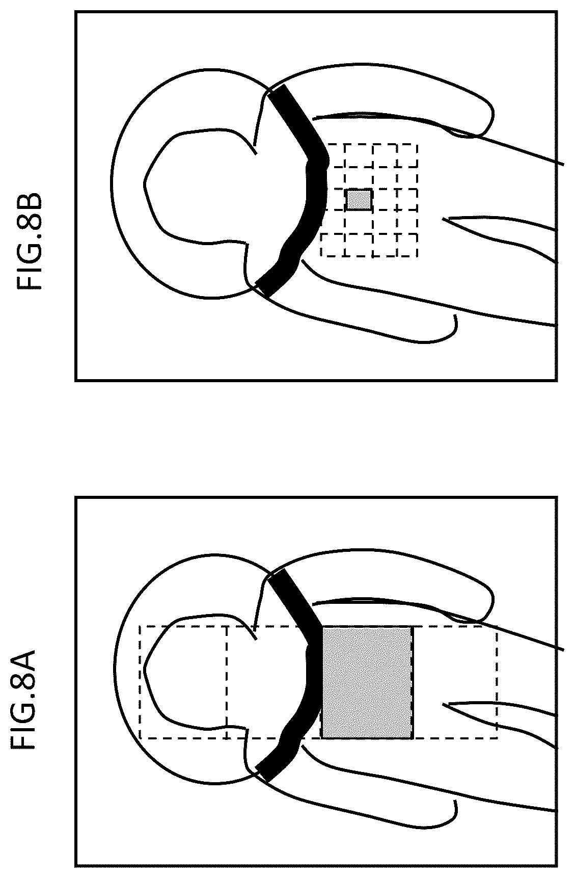 Patent US12310761 Figure 8 – Medical imaging apparatus including biological signal processing system, medical imaging system, and biological signal processing method