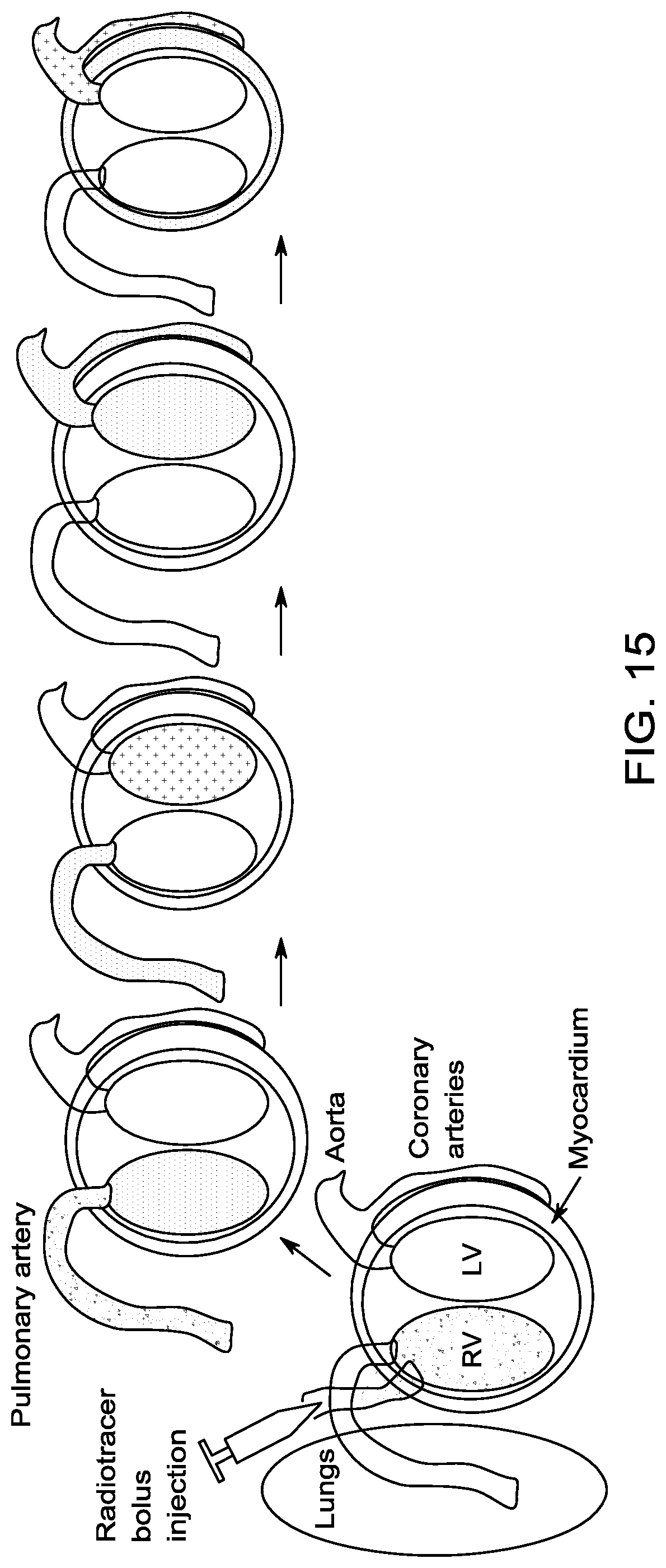 Patent US12310765 Figure 14 – System and method for measuring radiotracer bolus morphology for quantitative analysis