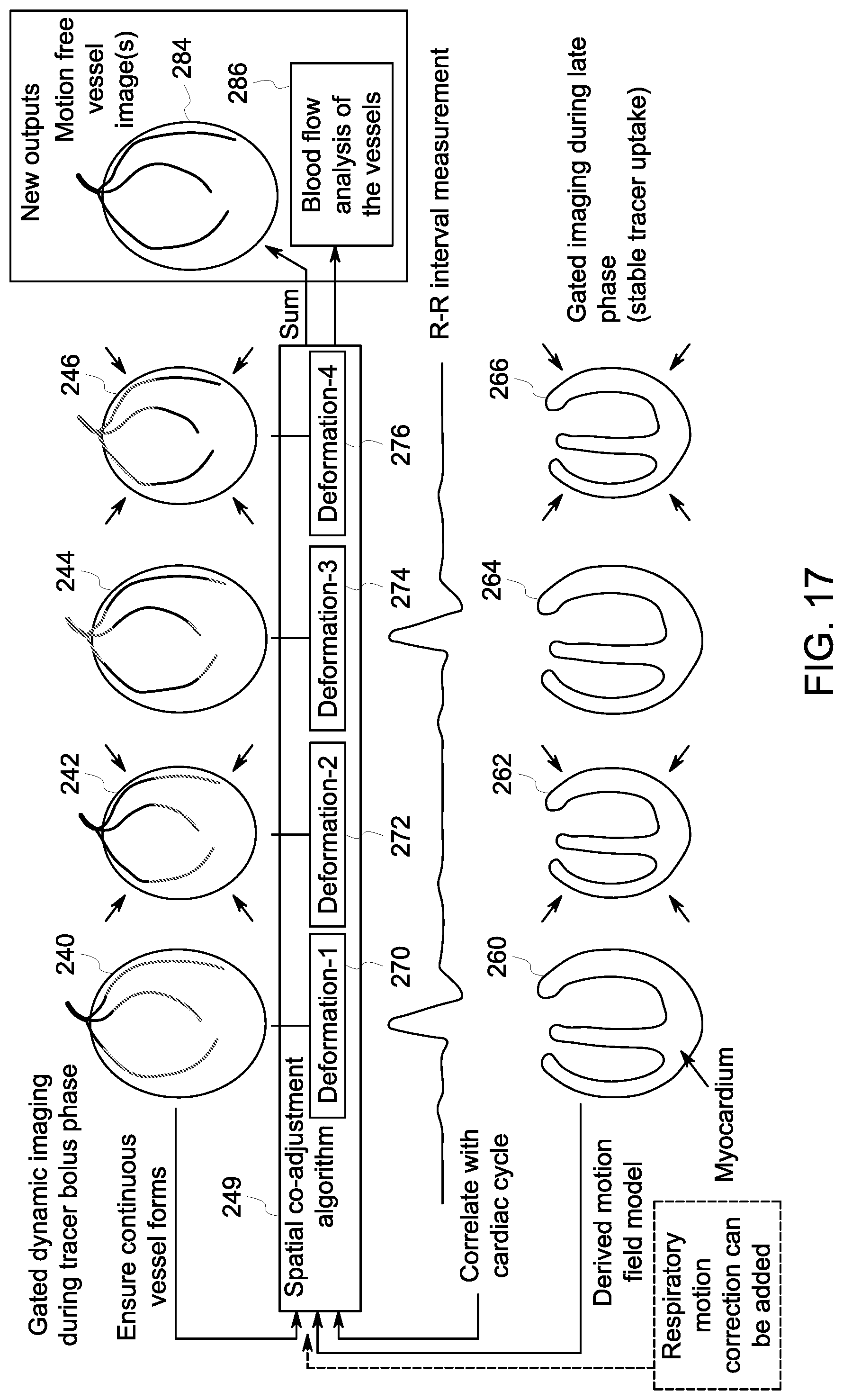 Patent US12310765 Figure 16 – System and method for measuring radiotracer bolus morphology for quantitative analysis
