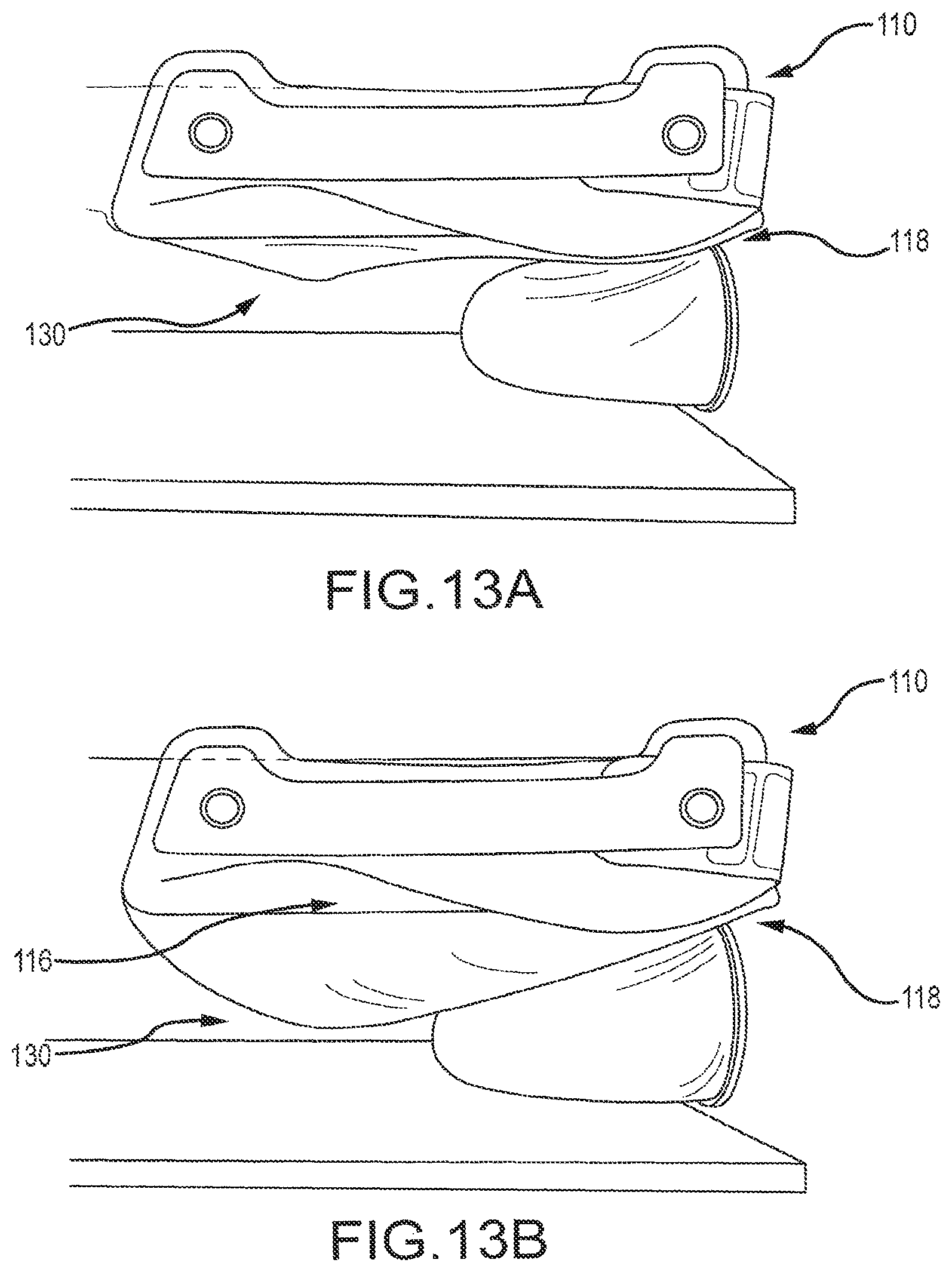 Patent US12310766 Figure 10 – X-ray mammography and/or breast tomosynthesis using a compression paddle