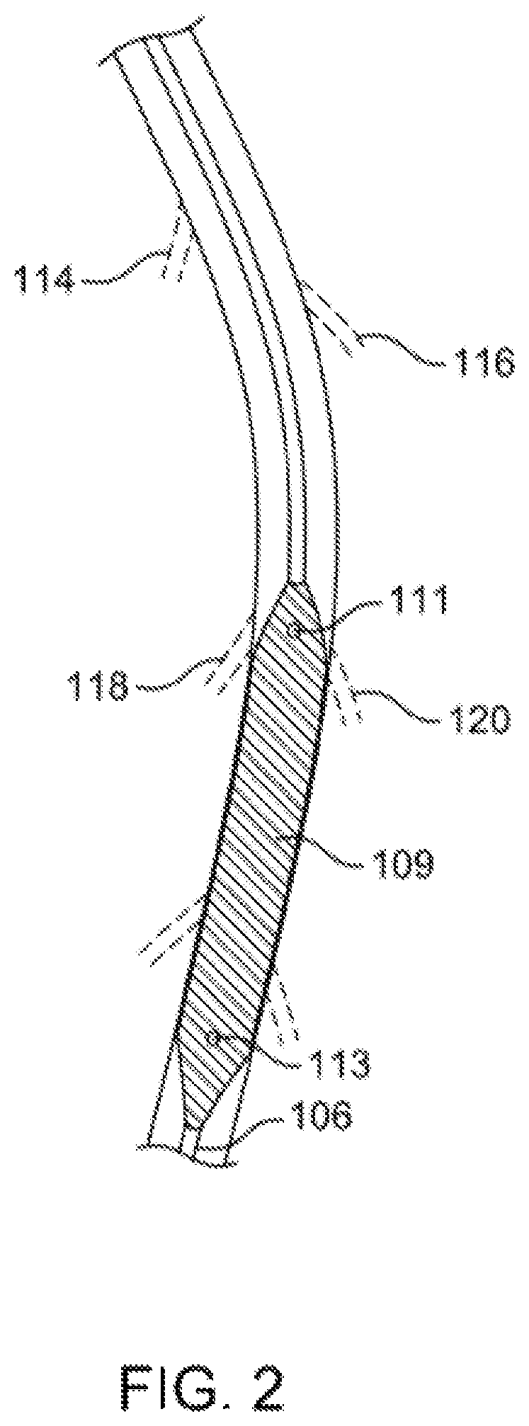 Patent US12310769 Figure 2 – Method for performing angiography and angioplasty within lumen of a blood vessel