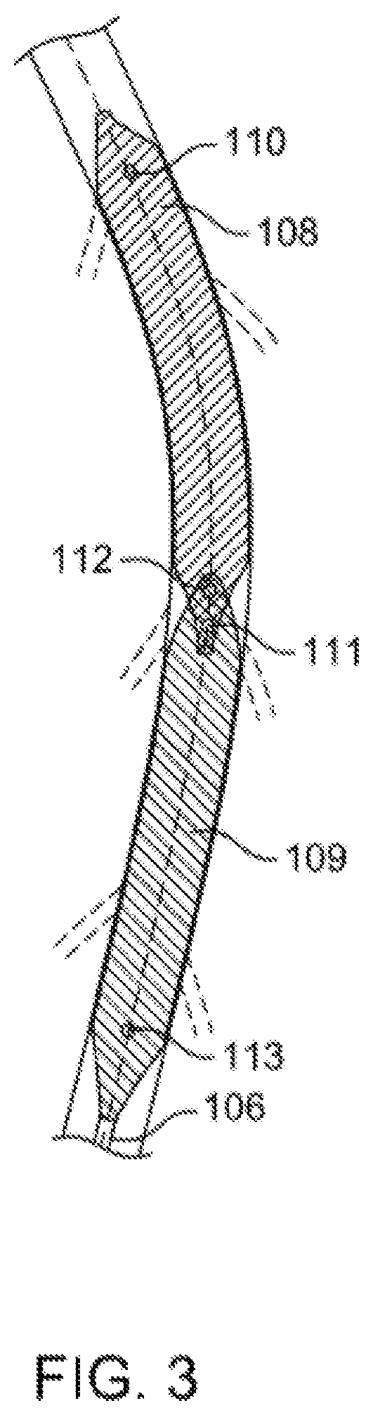 Patent US12310769 Figure 3 – Method for performing angiography and angioplasty within lumen of a blood vessel