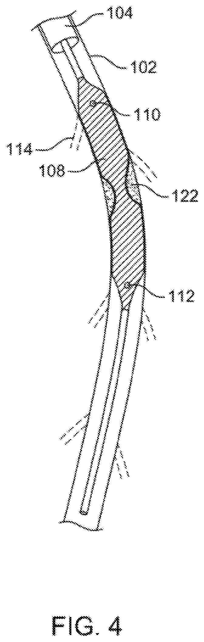 Patent US12310769 Figure 4 – Method for performing angiography and angioplasty within lumen of a blood vessel