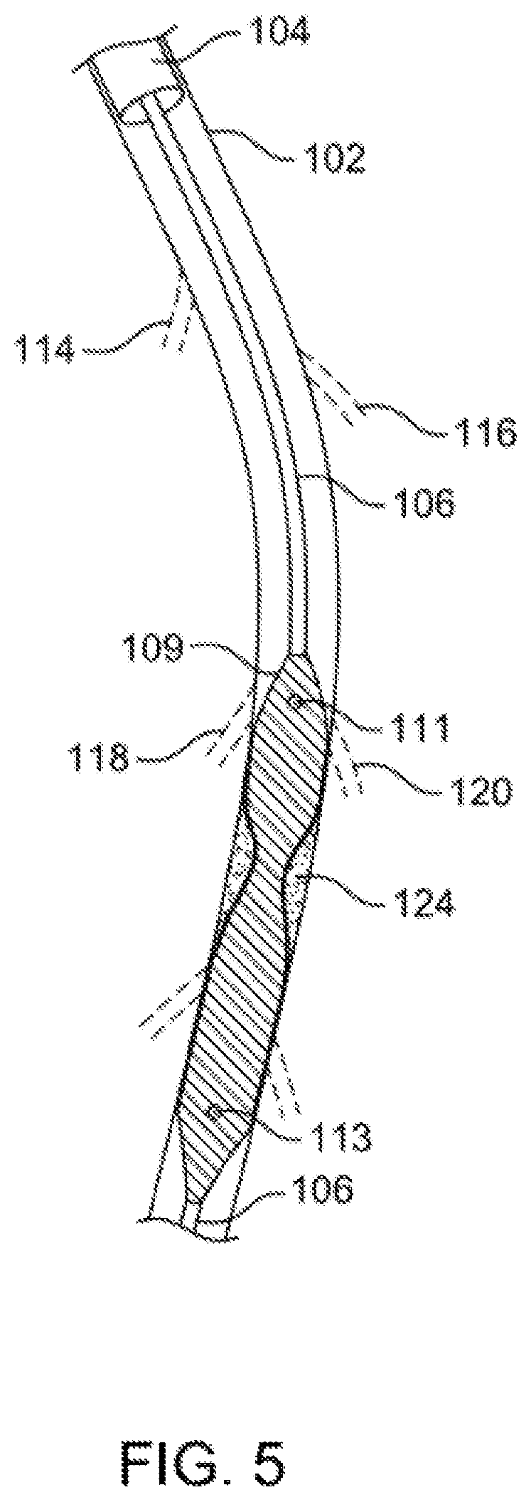 Patent US12310769 Figure 5 – Method for performing angiography and angioplasty within lumen of a blood vessel
