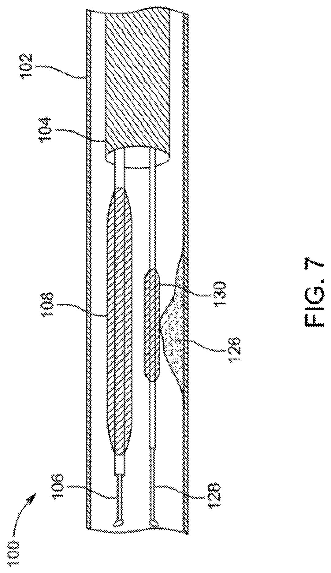 Patent US12310769 Figure 7 – Method for performing angiography and angioplasty within lumen of a blood vessel