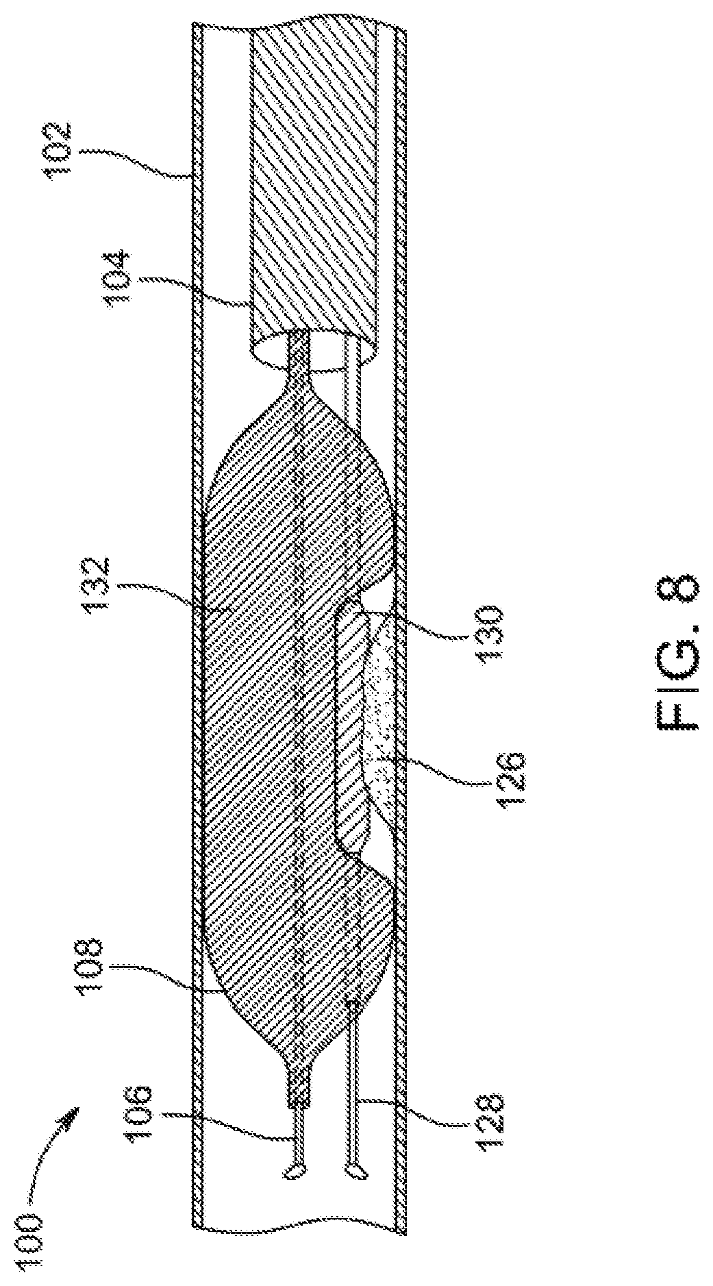 Patent US12310769 Figure 8 – Method for performing angiography and angioplasty within lumen of a blood vessel