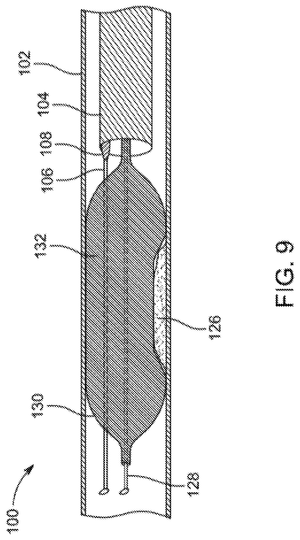 Patent US12310769 Figure 9 – Method for performing angiography and angioplasty within lumen of a blood vessel
