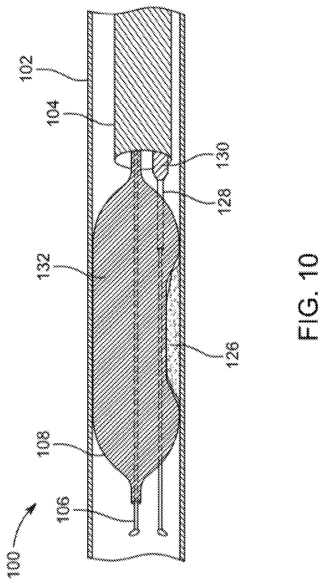 Patent US12310769 Figure 10 – Method for performing angiography and angioplasty within lumen of a blood vessel