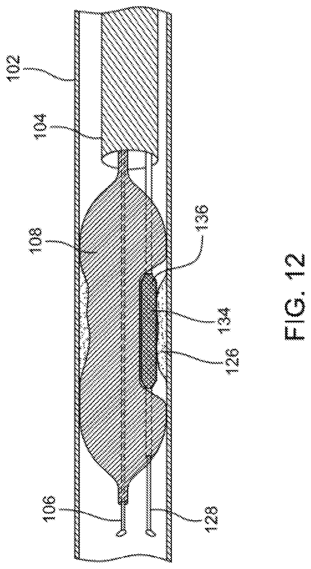 Patent US12310769 Figure 12 – Method for performing angiography and angioplasty within lumen of a blood vessel