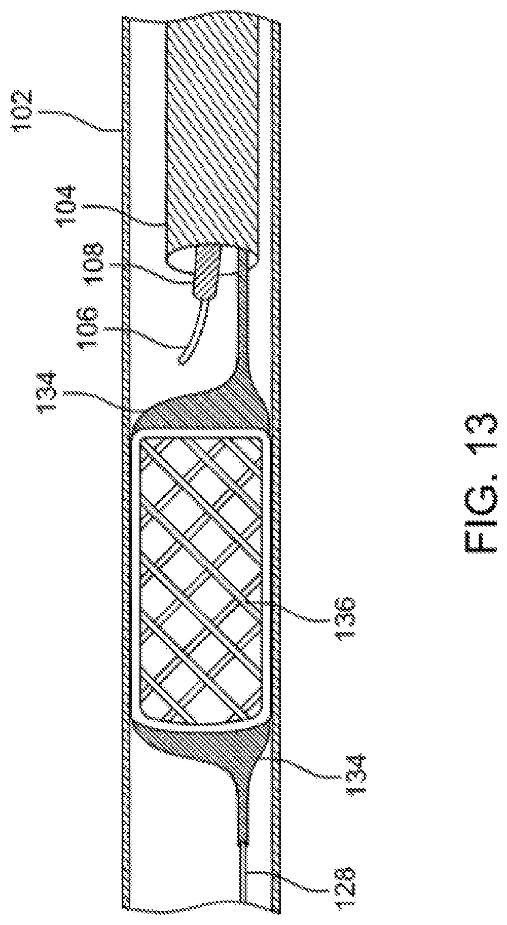 Patent US12310769 Figure 13 – Method for performing angiography and angioplasty within lumen of a blood vessel