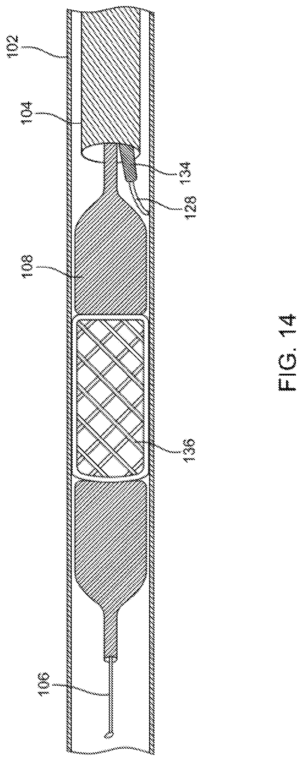 Patent US12310769 Figure 14 – Method for performing angiography and angioplasty within lumen of a blood vessel