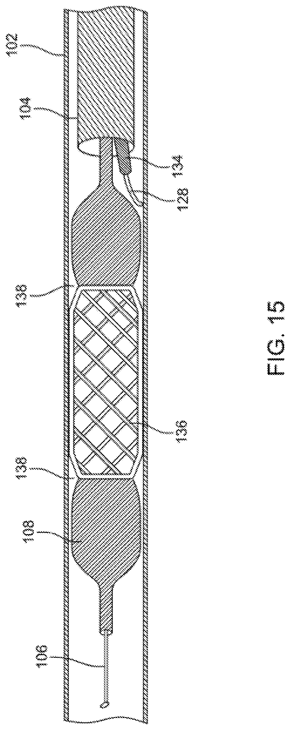 Patent US12310769 Figure 15 – Method for performing angiography and angioplasty within lumen of a blood vessel