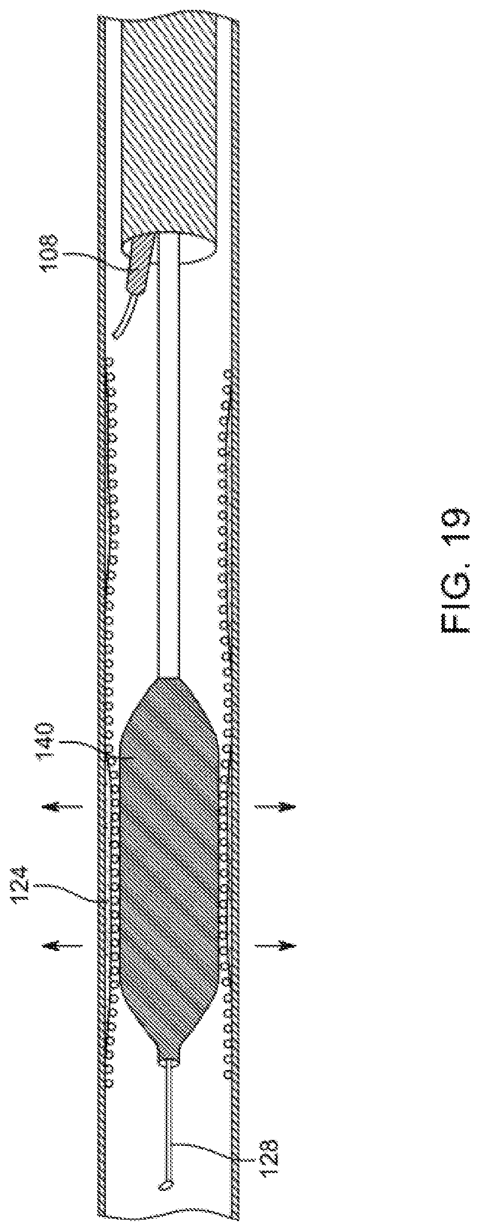 Patent US12310769 Figure 19 – Method for performing angiography and angioplasty within lumen of a blood vessel