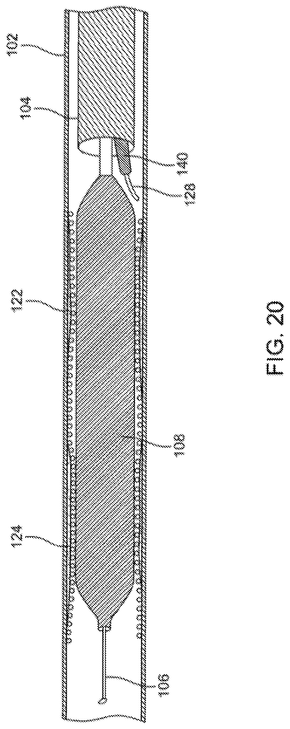 Patent US12310769 Figure 20 – Method for performing angiography and angioplasty within lumen of a blood vessel