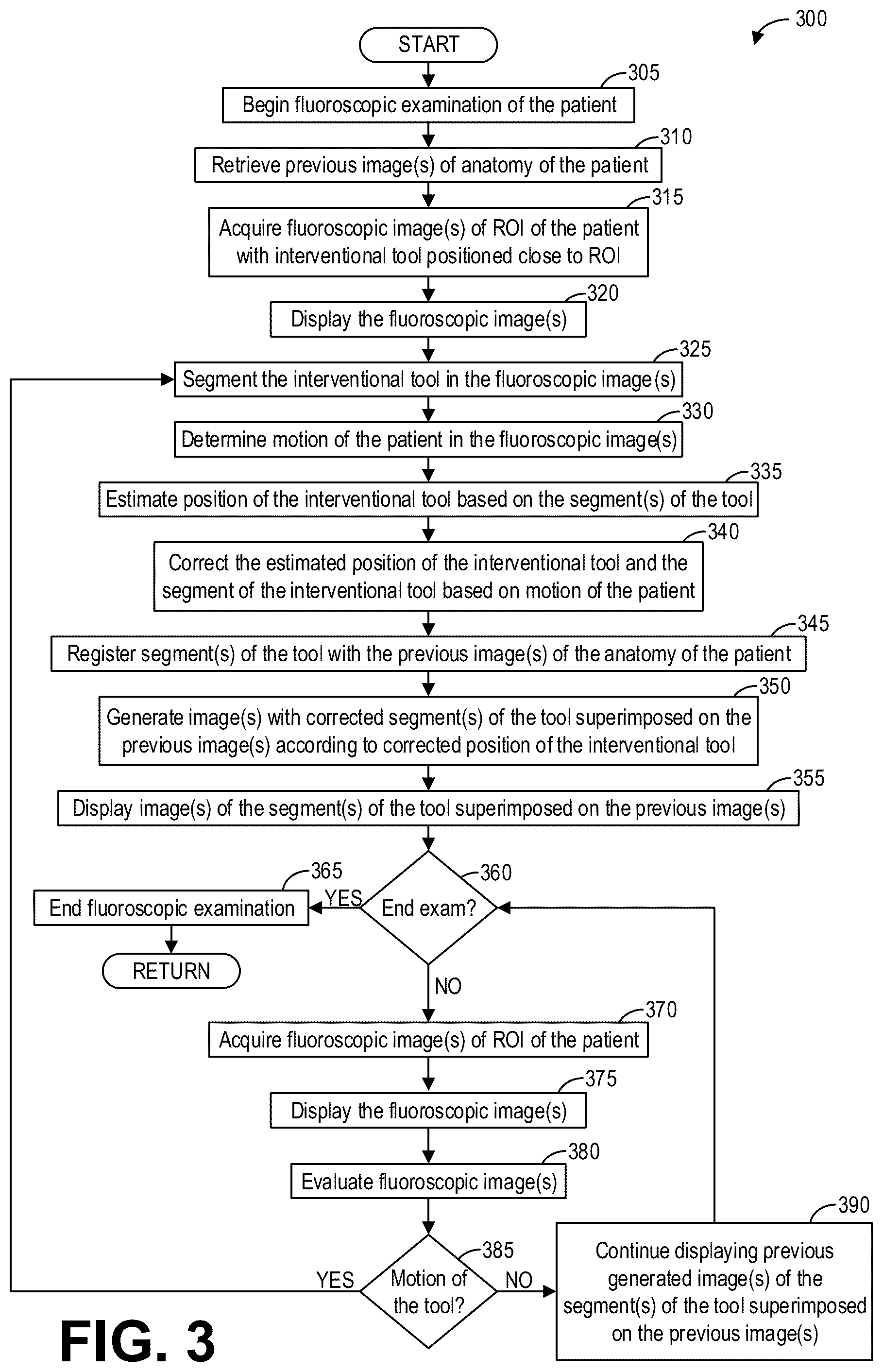 Patent US12310770 Figure 3 – Method and systems for motion-stabilized clinical tool tracking and visualization