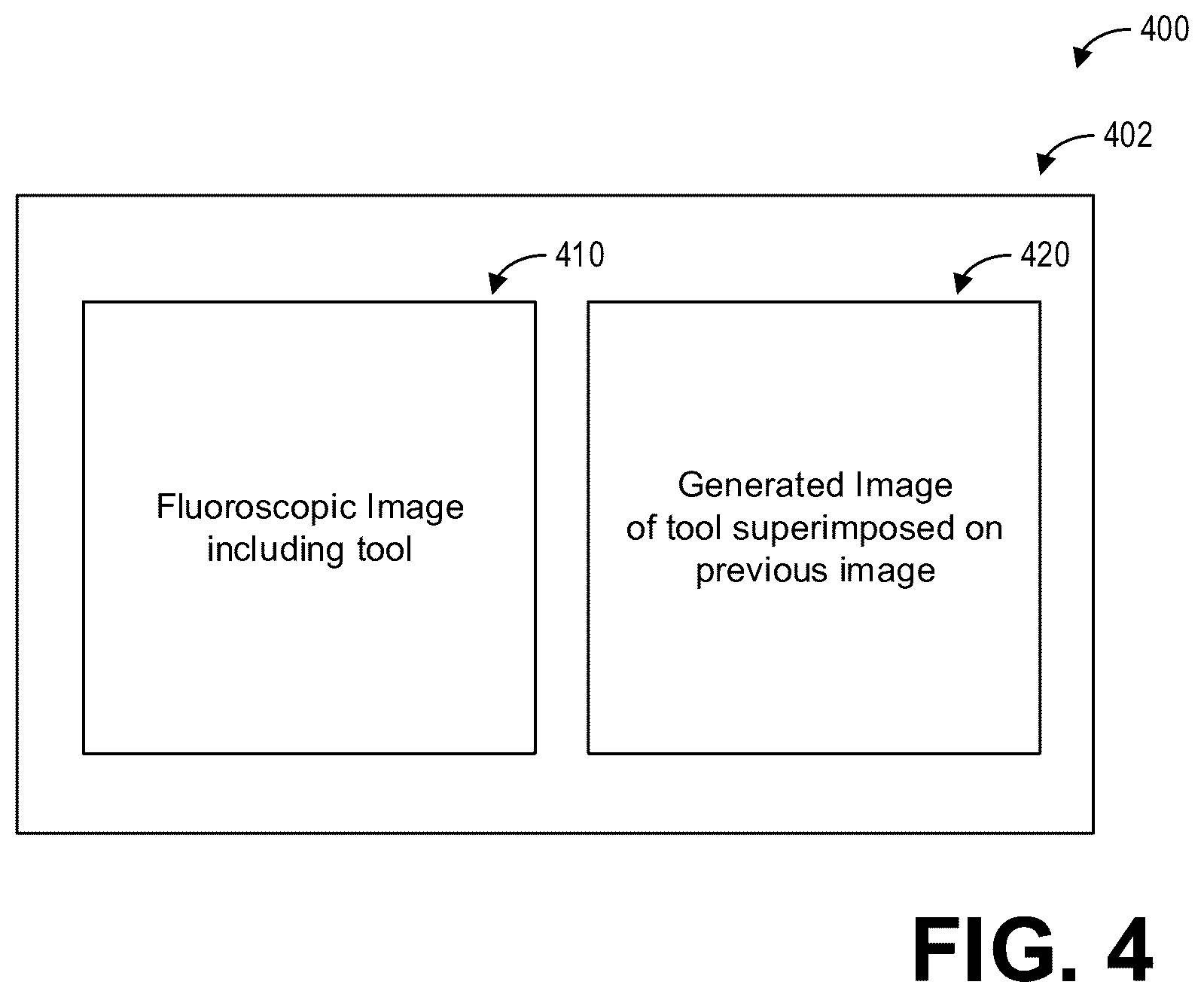 Patent US12310770 Figure 4 – Method and systems for motion-stabilized clinical tool tracking and visualization