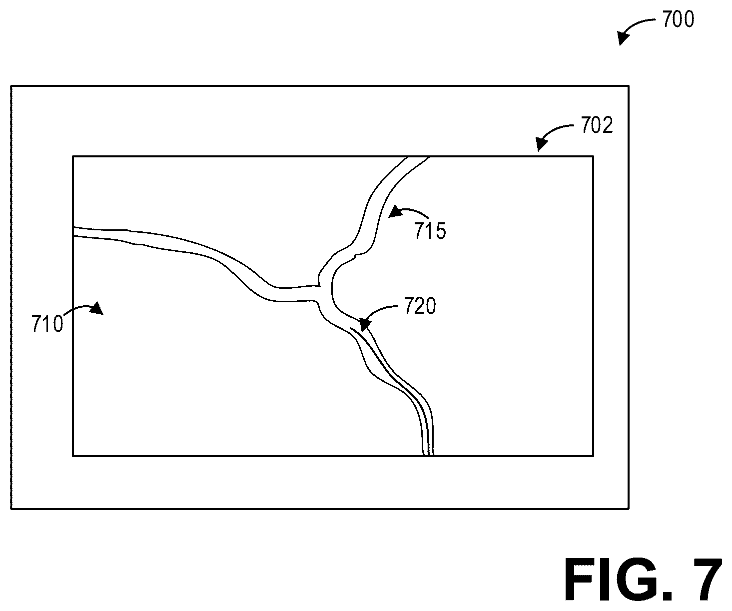 Patent US12310770 Figure 7 – Method and systems for motion-stabilized clinical tool tracking and visualization