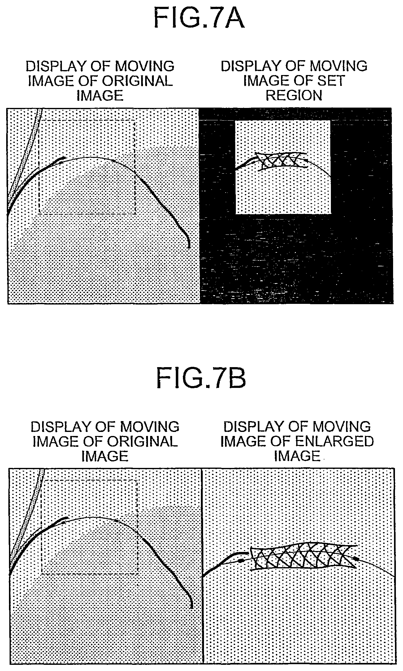 Patent US12310771 Figure 5 – X-ray diagnosis apparatus and image processing apparatus
