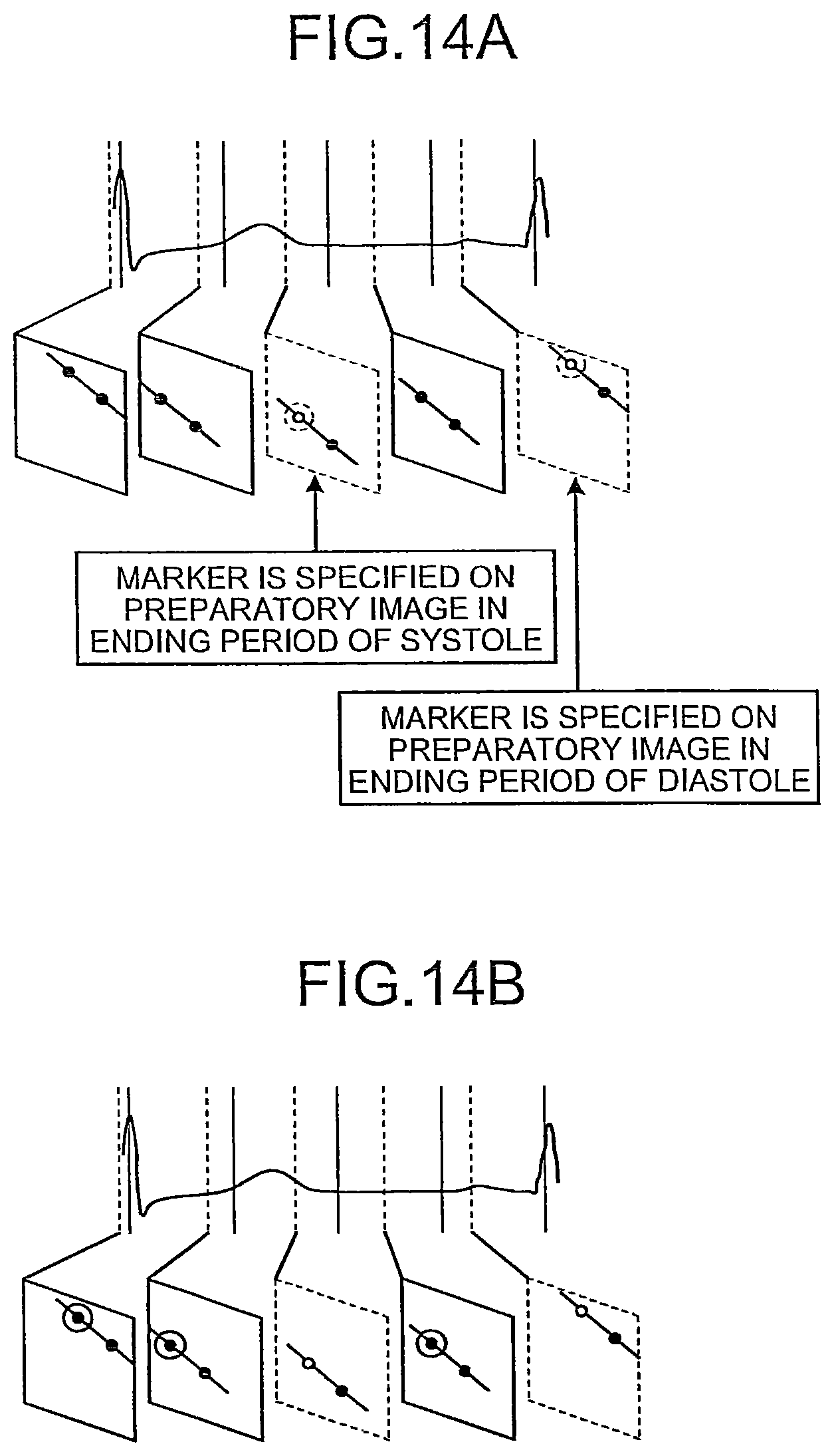 Patent US12310771 Figure 11 – X-ray diagnosis apparatus and image processing apparatus