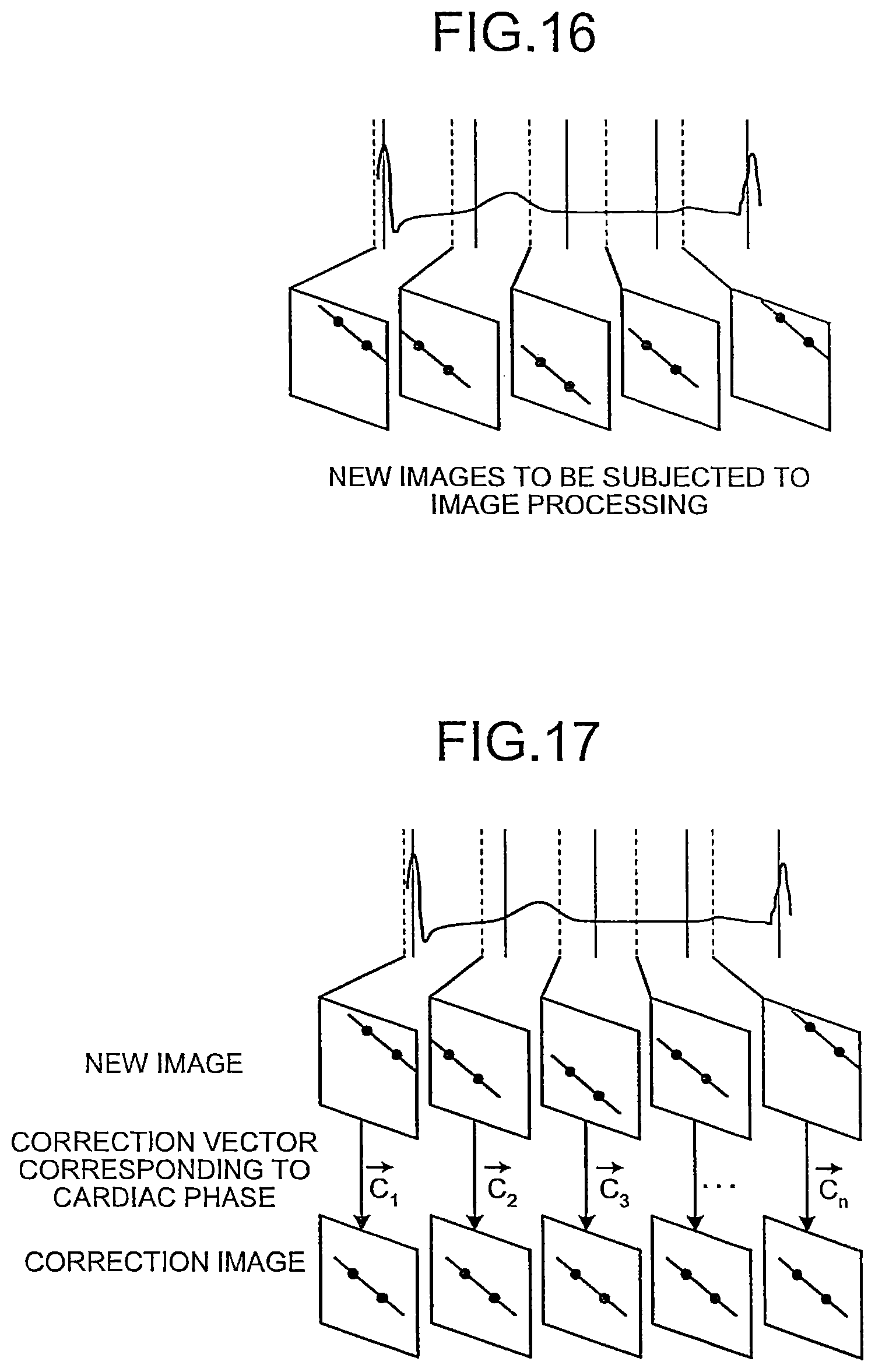 Patent US12310771 Figure 13 – X-ray diagnosis apparatus and image processing apparatus