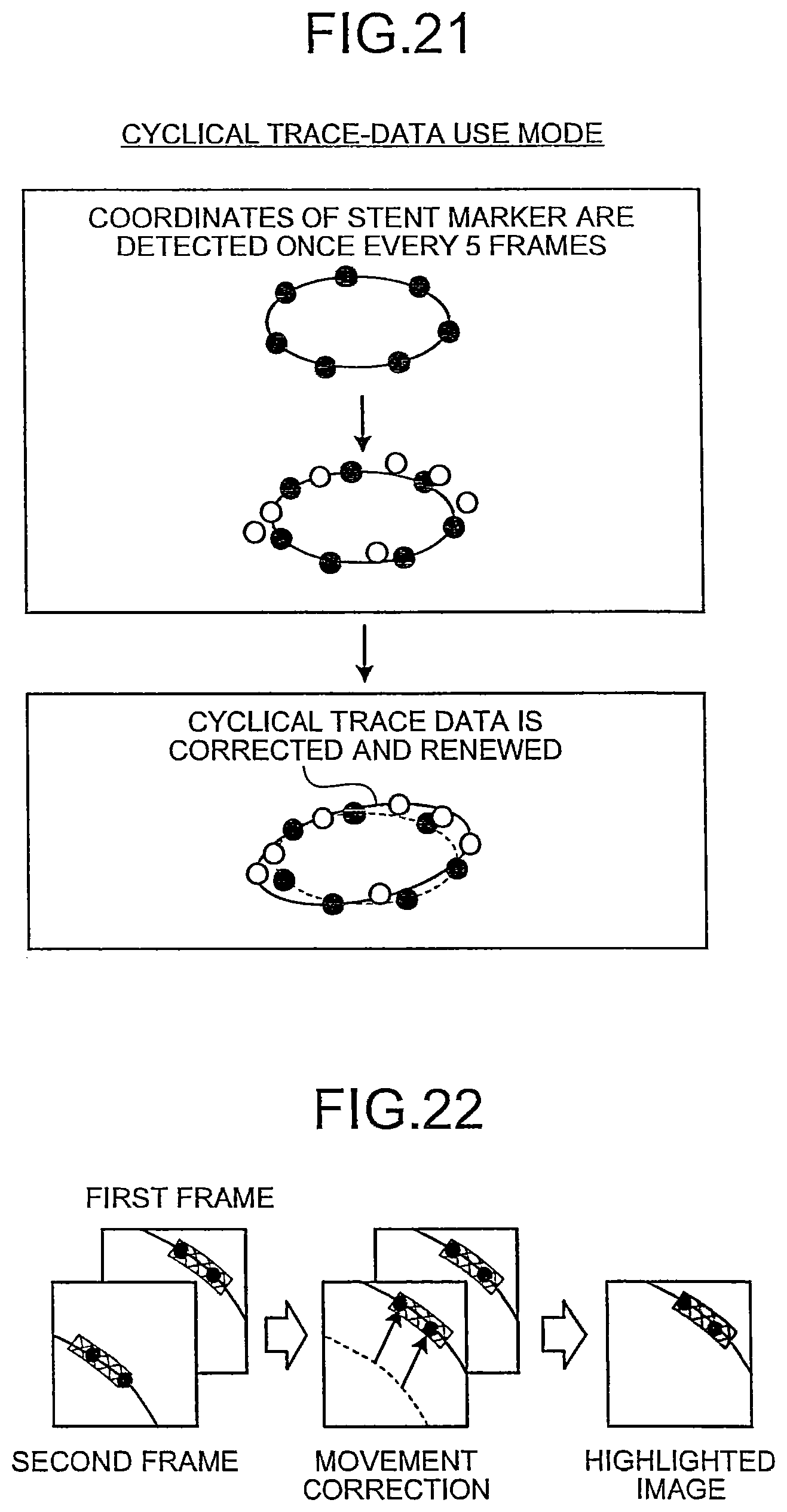 Patent US12310771 Figure 17 – X-ray diagnosis apparatus and image processing apparatus
