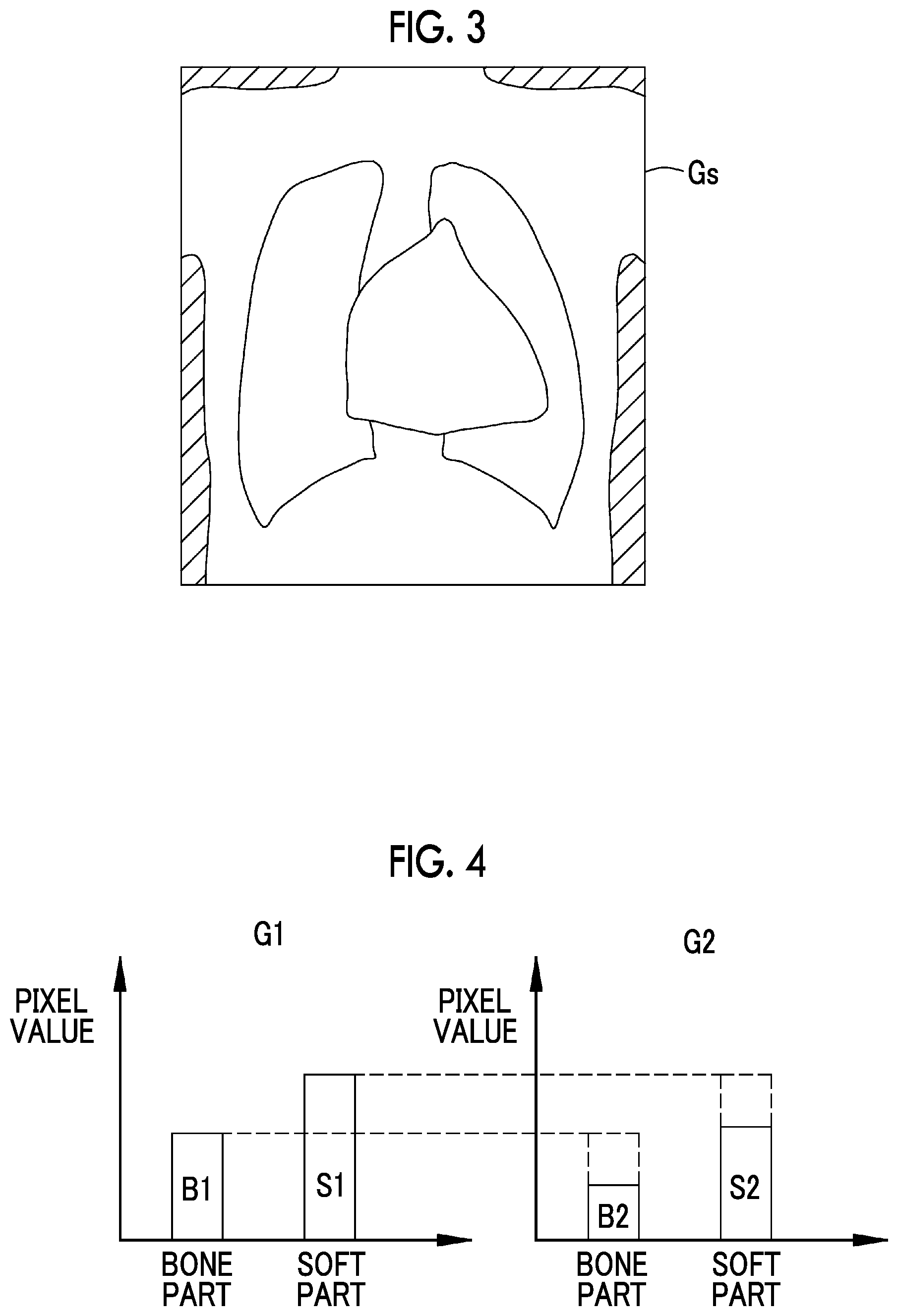Patent US12310777 Figure 2 – Subject information acquisition device, method for operating subject information acquisition device, and non-transitory computer readable medium