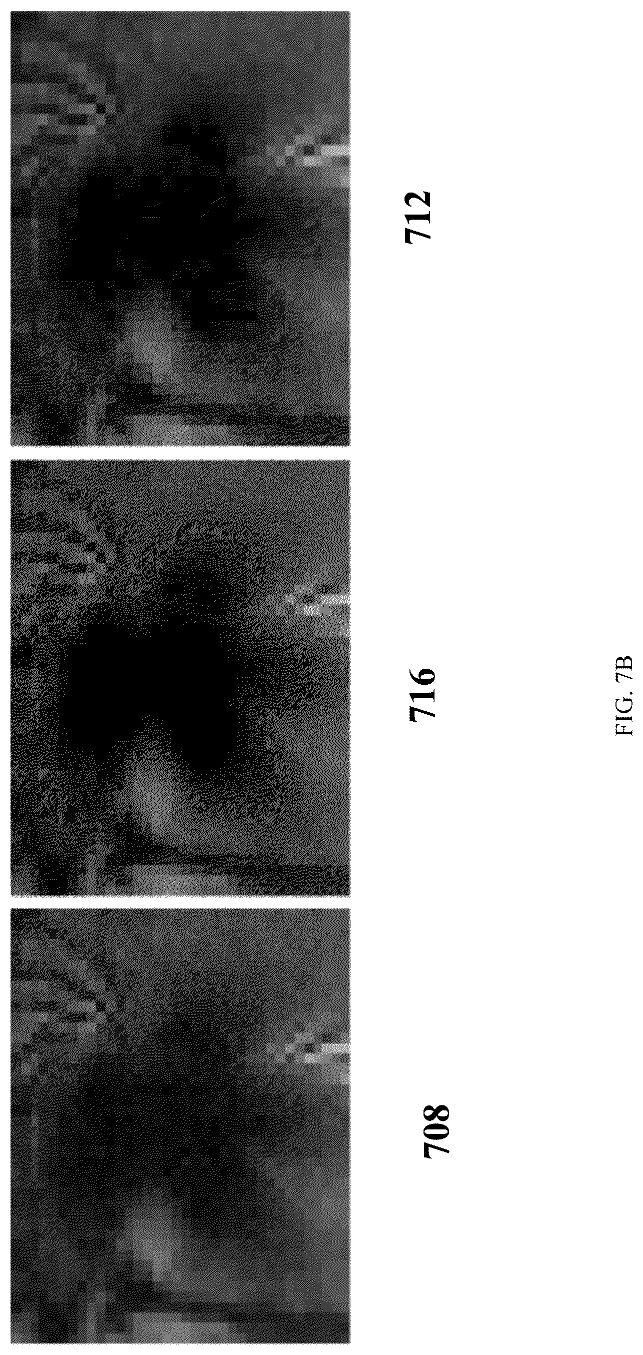 Patent US12310778 Figure 10 – Apparatus and methods for improved denoising in magnetic resonance imaging based on metal artifact reduction