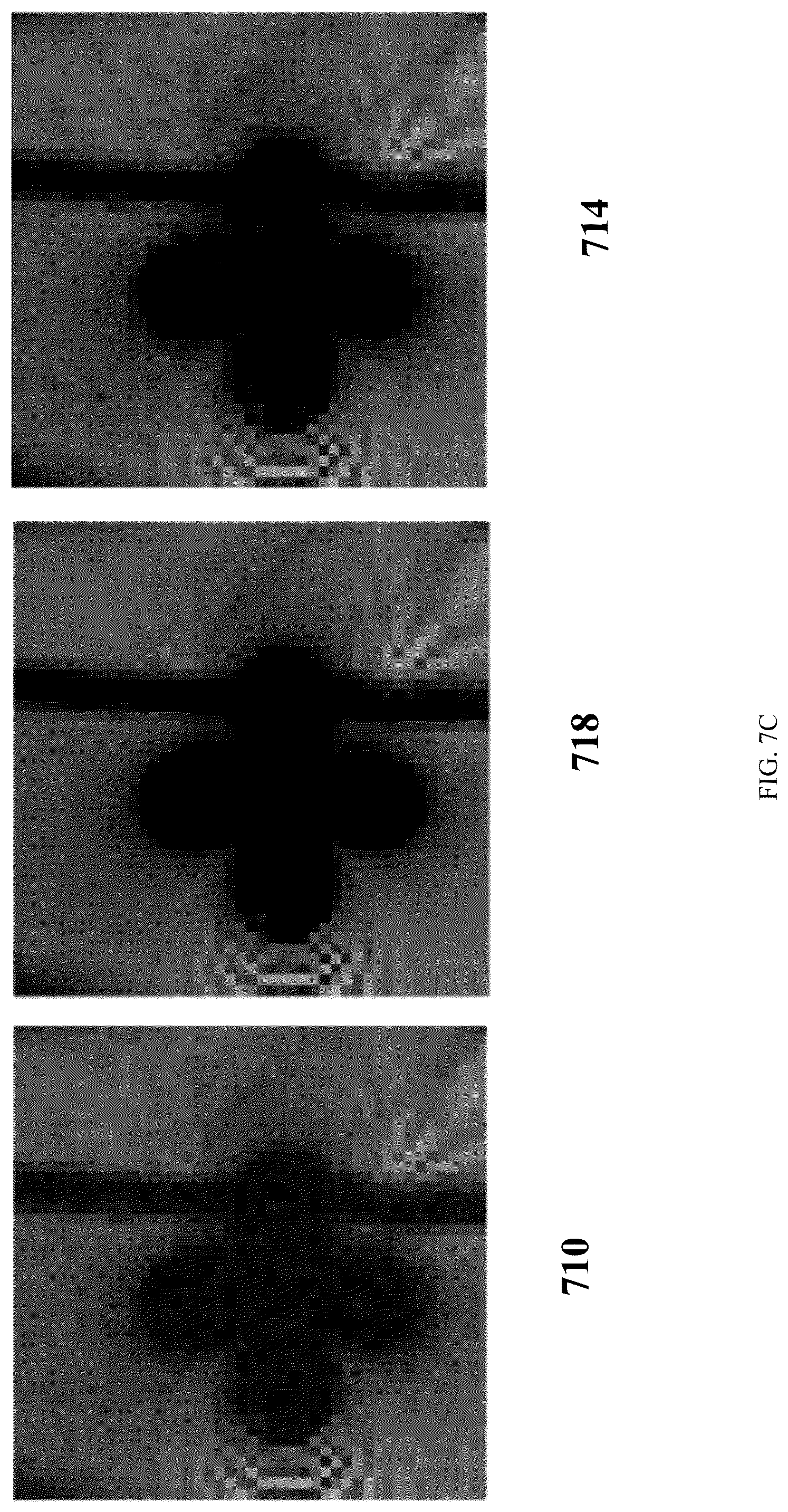 Patent US12310778 Figure 11 – Apparatus and methods for improved denoising in magnetic resonance imaging based on metal artifact reduction