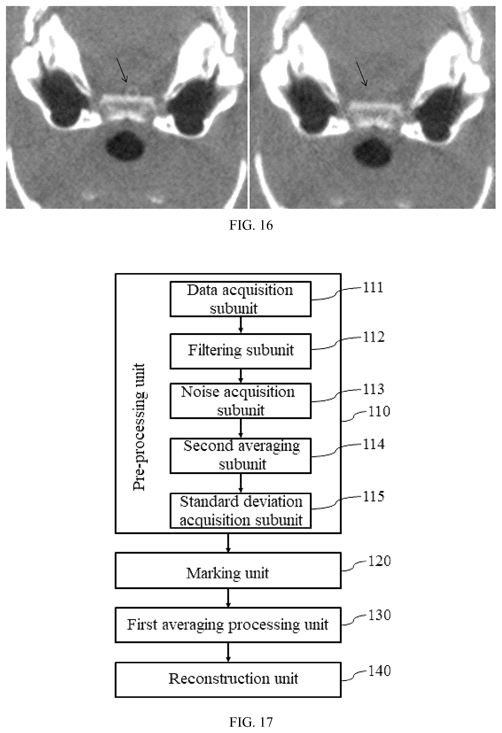 Patent US12310779 Figure 6 – Method and device of correction of ring artifact in CT image and computer program medium