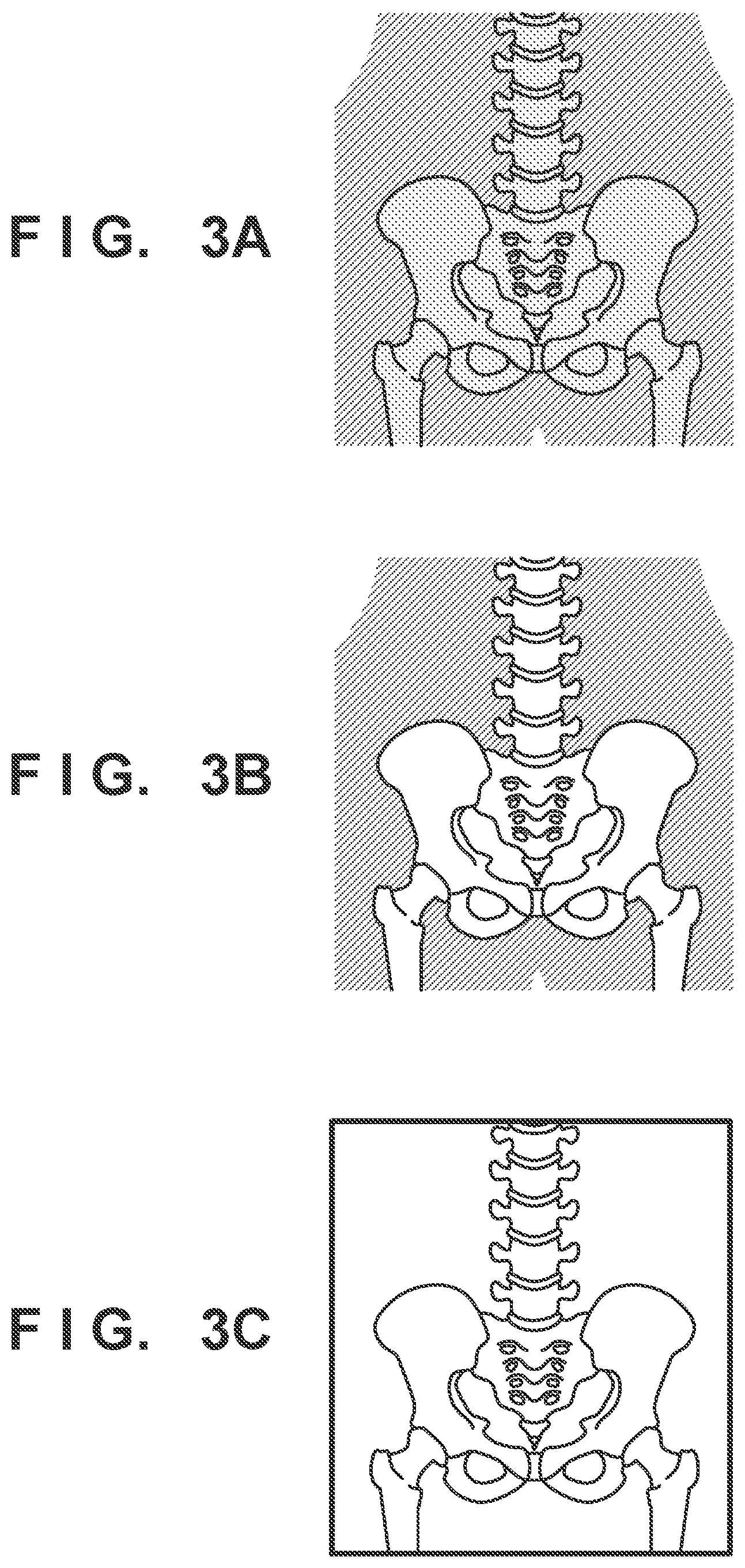 Patent US12310782 Figure 3 – X-ray image processing apparatus, x-ray diagnosis apparatus, method, and storage medium