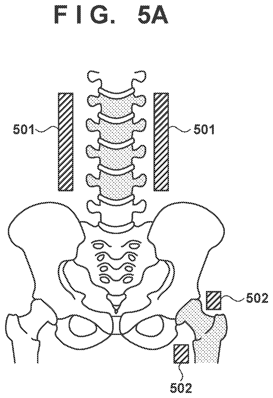 Patent US12310782 Figure 5 – X-ray image processing apparatus, x-ray diagnosis apparatus, method, and storage medium