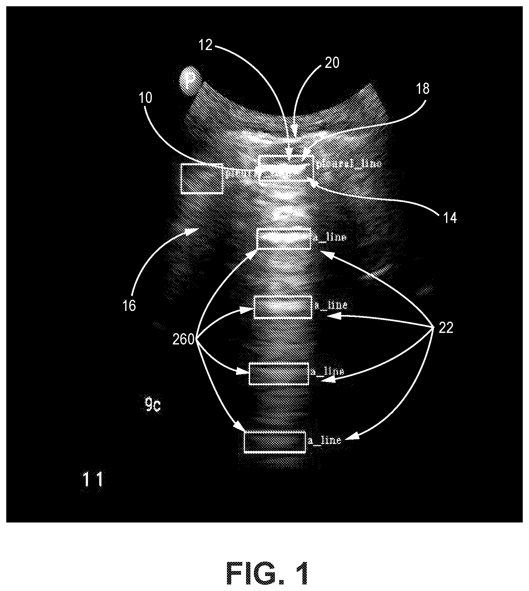 Patent US12310783 Figure 1 – Automated ultrasound video interpretation of a body part with one or more convolutional neural networks