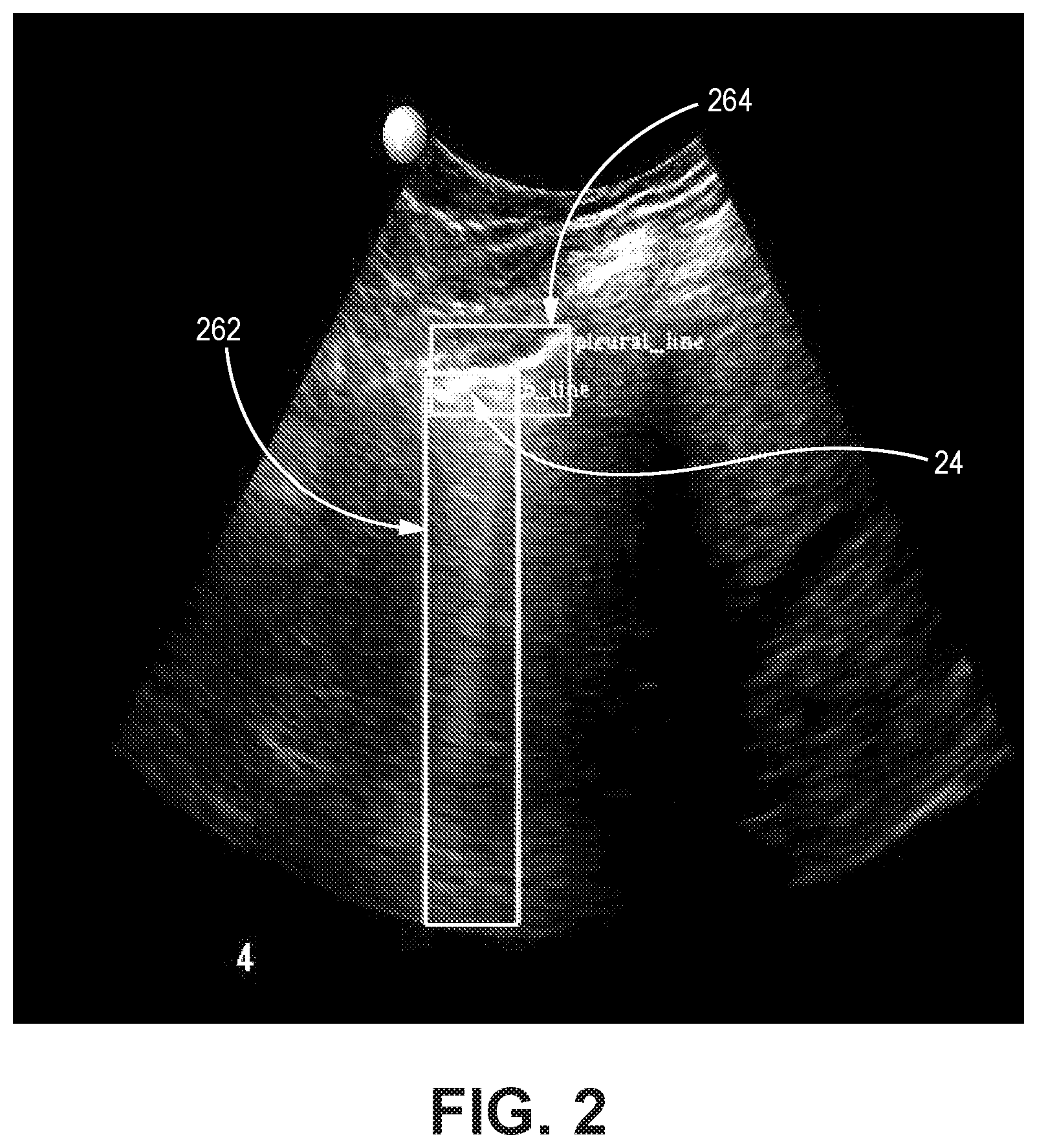 Patent US12310783 Figure 2 – Automated ultrasound video interpretation of a body part with one or more convolutional neural networks
