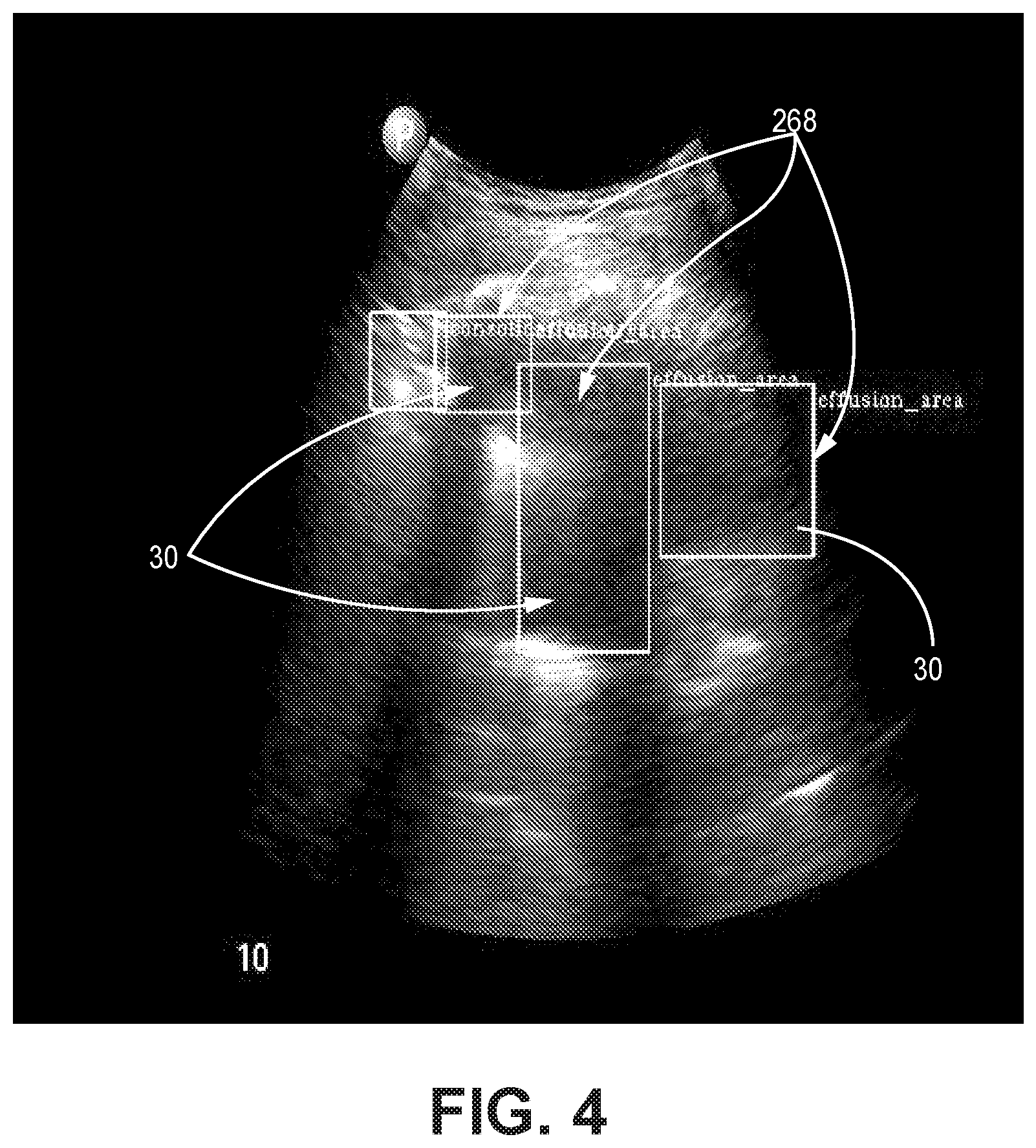 Patent US12310783 Figure 4 – Automated ultrasound video interpretation of a body part with one or more convolutional neural networks