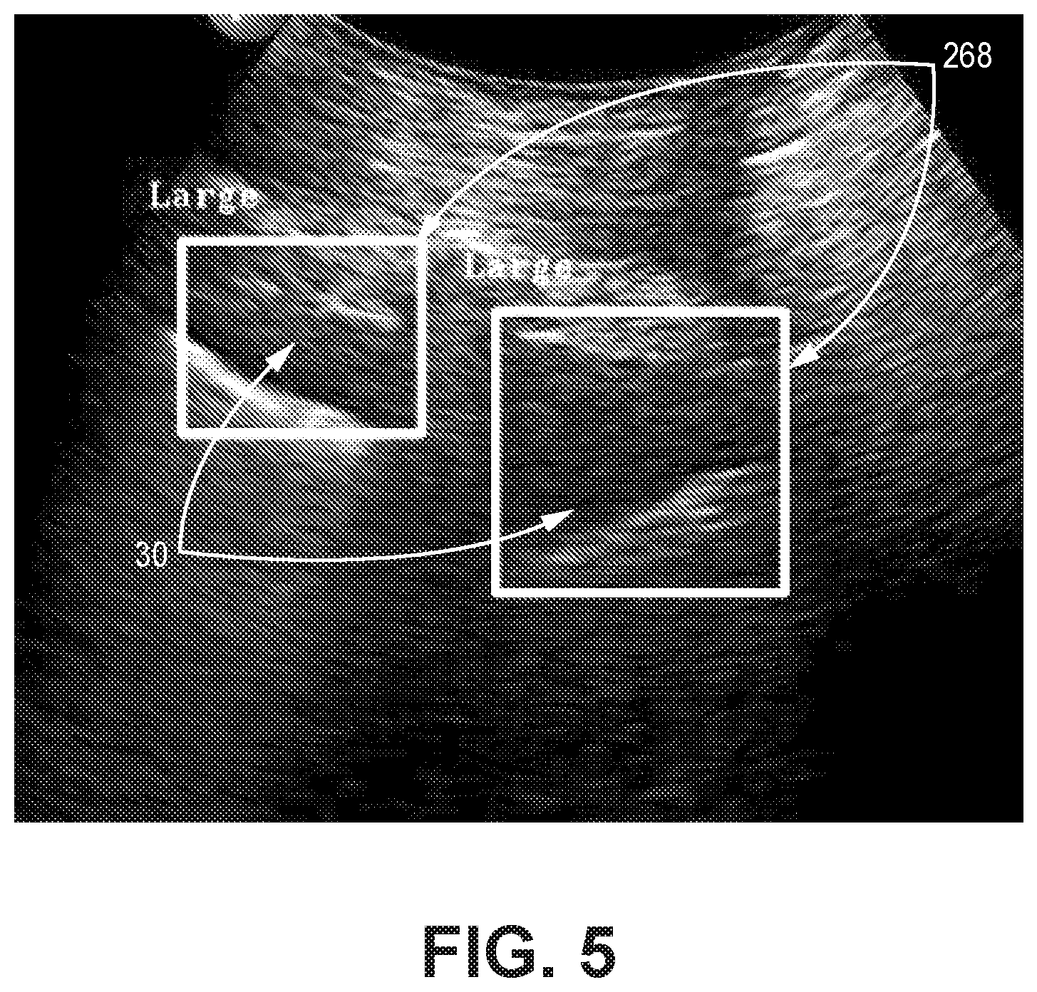 Patent US12310783 Figure 5 – Automated ultrasound video interpretation of a body part with one or more convolutional neural networks