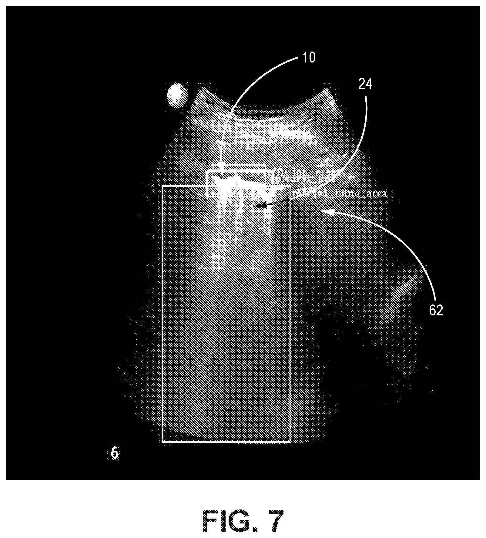 Patent US12310783 Figure 7 – Automated ultrasound video interpretation of a body part with one or more convolutional neural networks