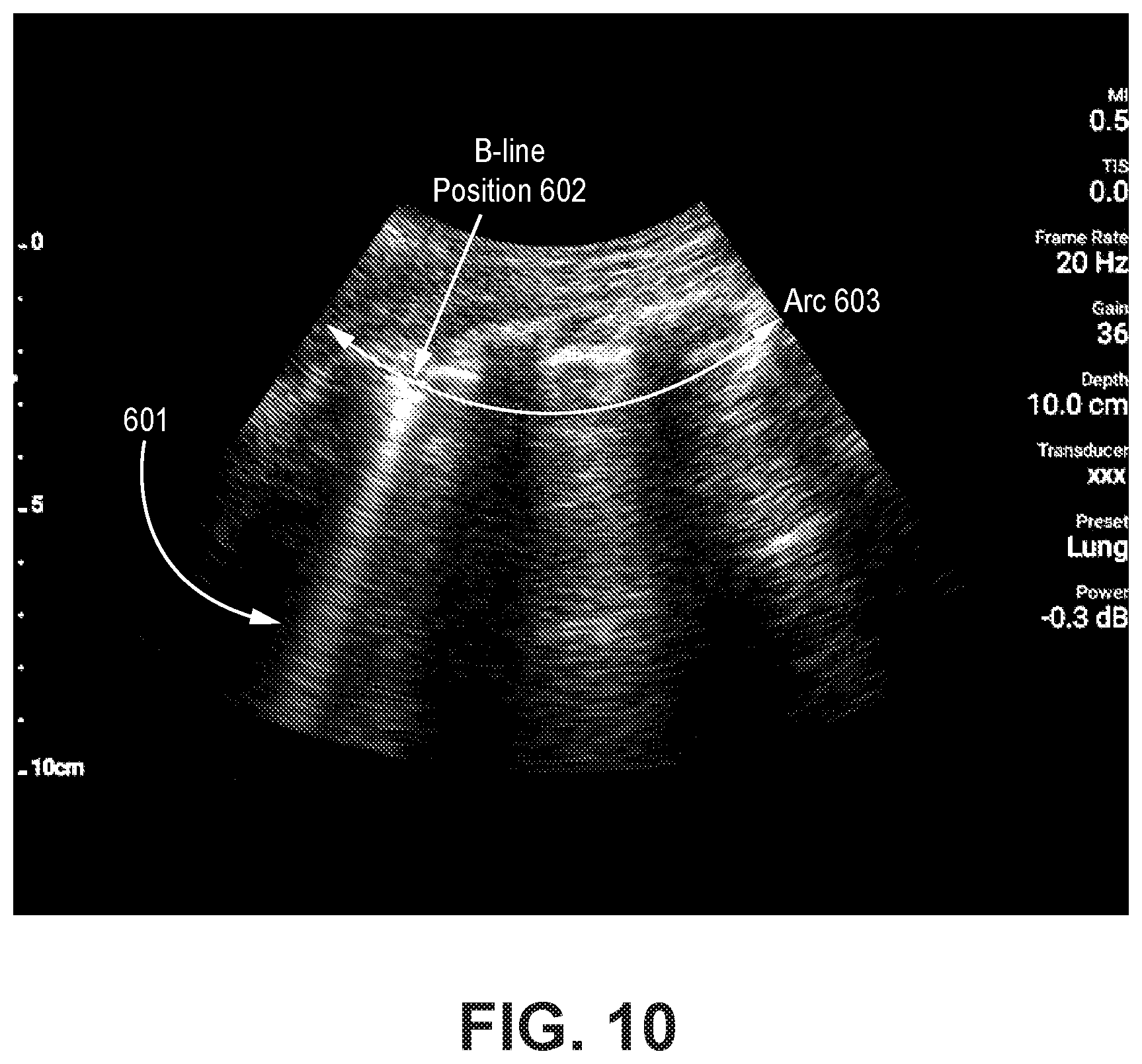 Patent US12310783 Figure 10 – Automated ultrasound video interpretation of a body part with one or more convolutional neural networks