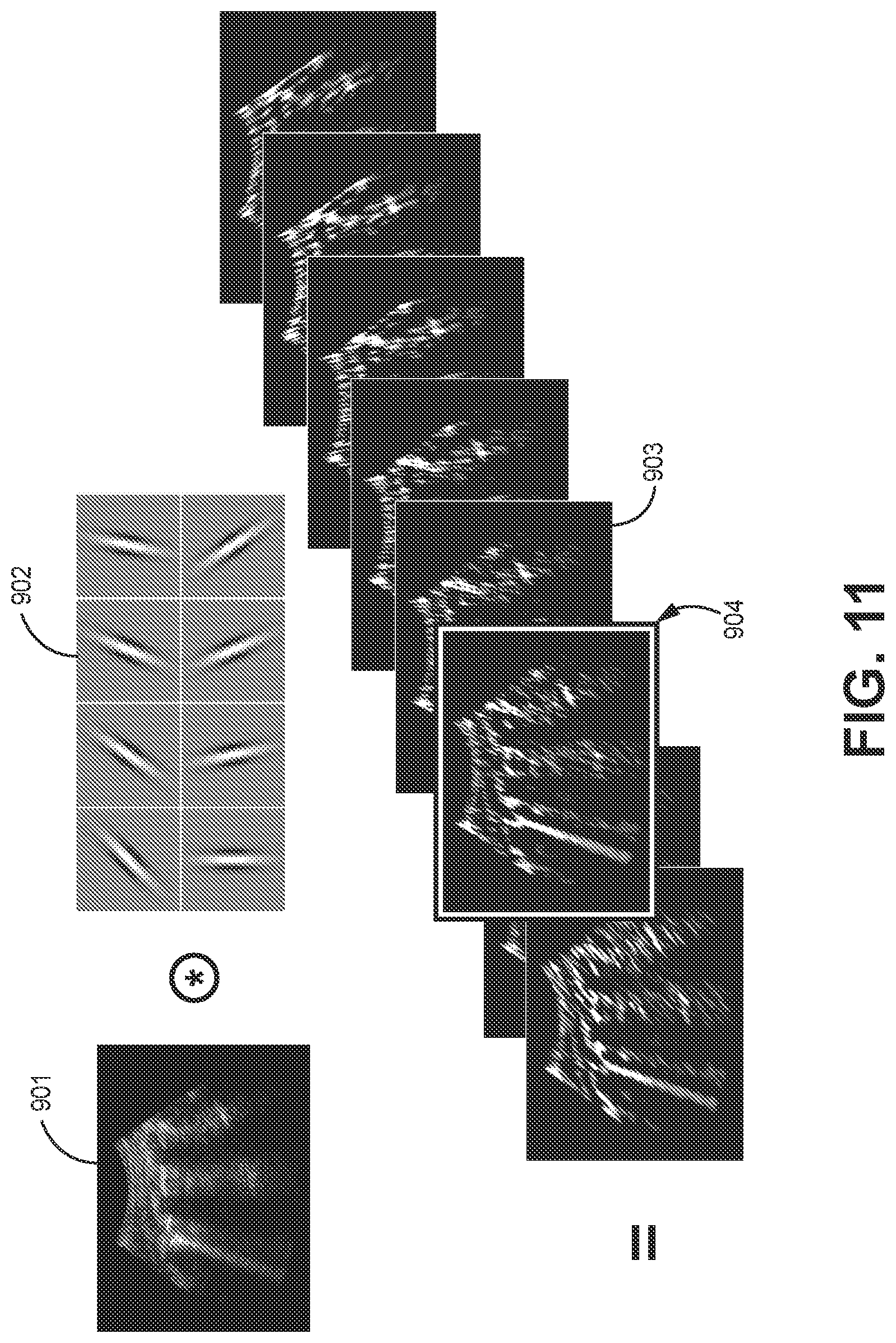 Patent US12310783 Figure 11 – Automated ultrasound video interpretation of a body part with one or more convolutional neural networks
