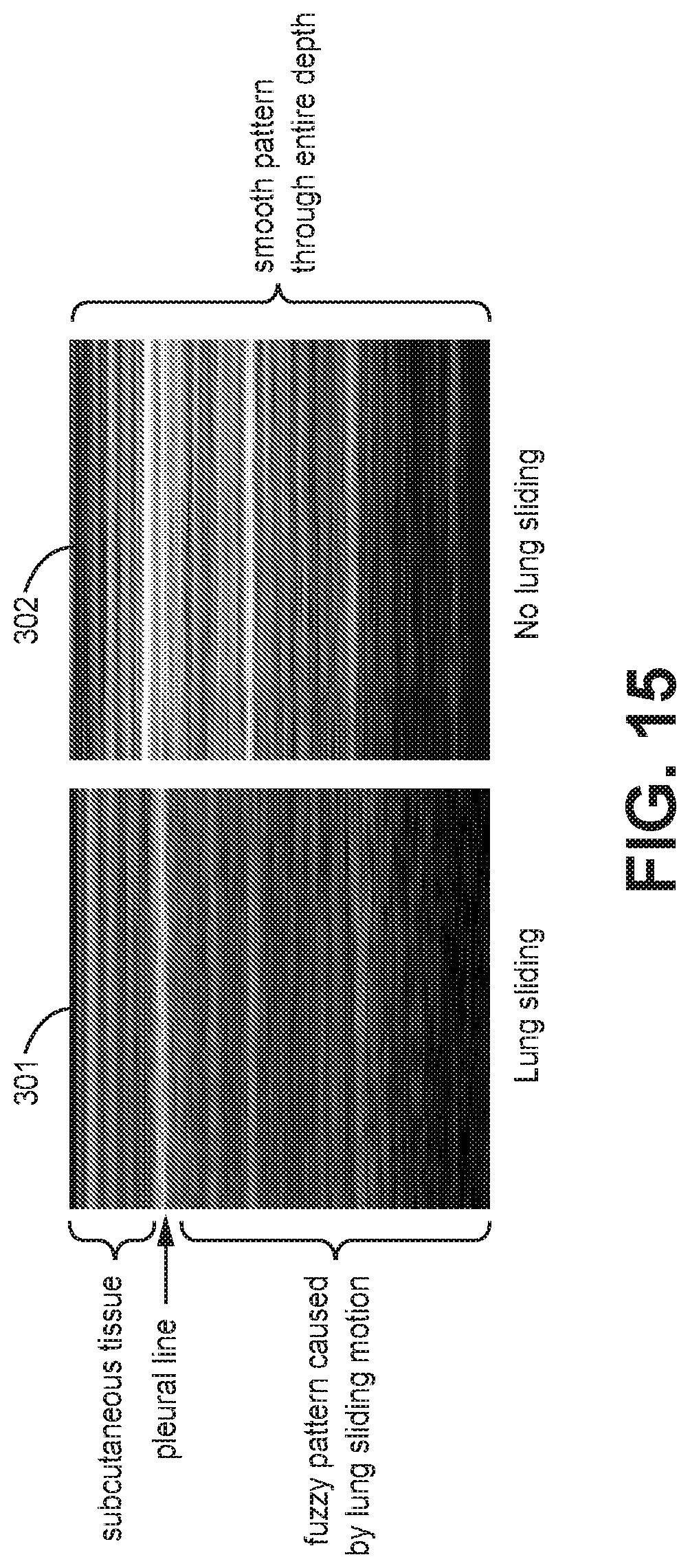 Patent US12310783 Figure 14 – Automated ultrasound video interpretation of a body part with one or more convolutional neural networks
