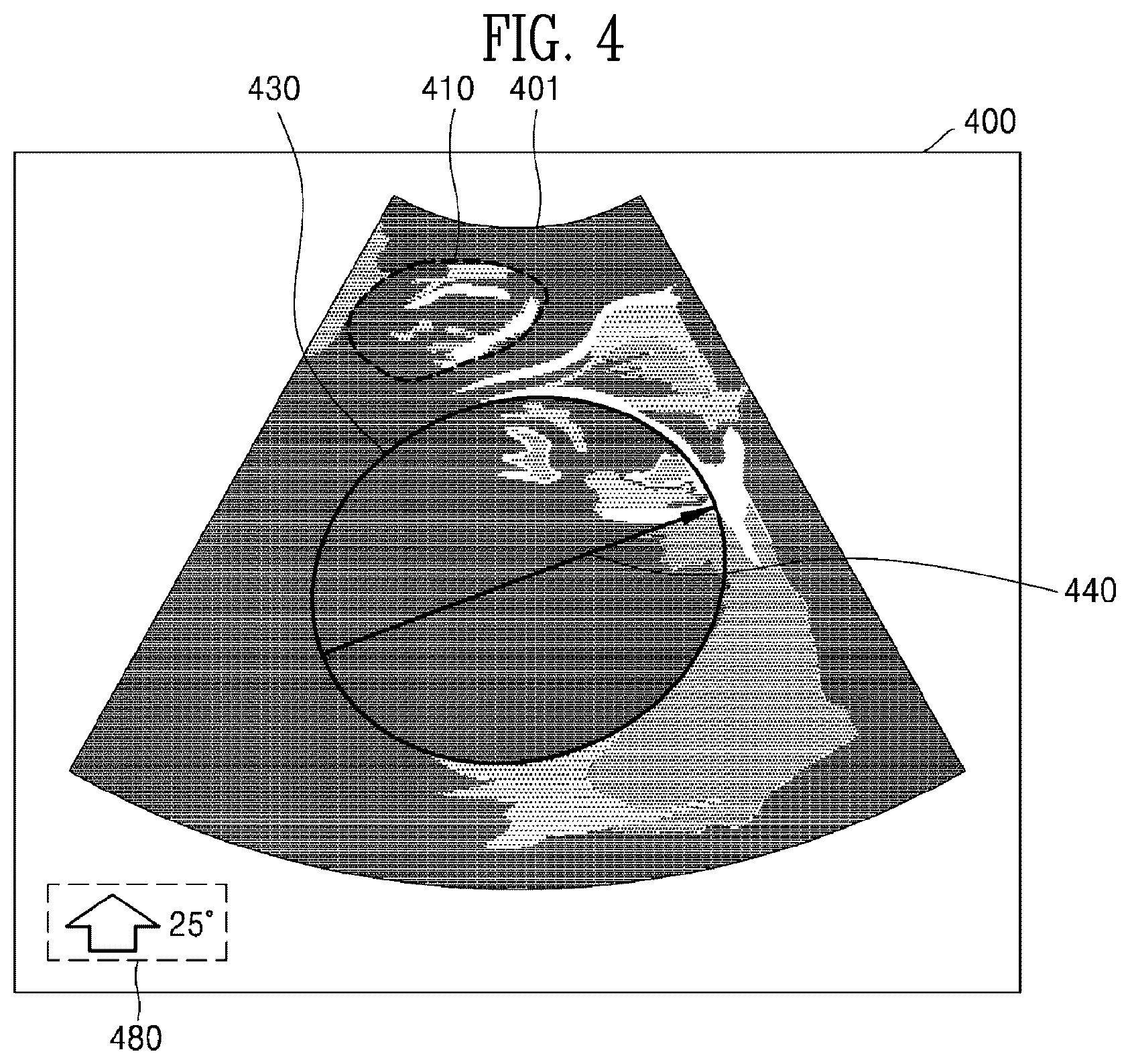 Patent US12310785 Figure 6 – Ultrasound imaging device and ultrasound image generation method for identifying degree of delivery progress of fetus