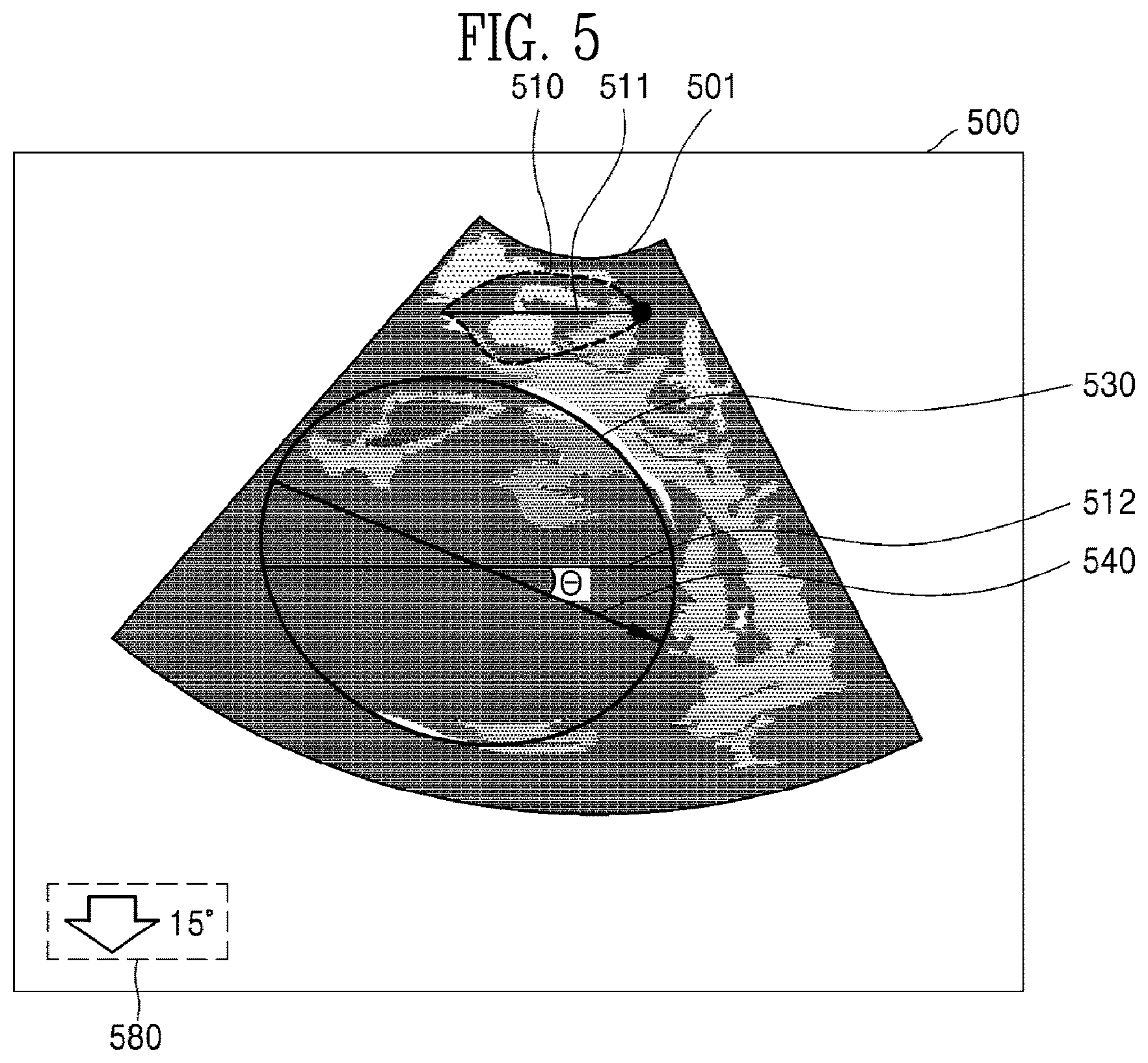 Patent US12310785 Figure 7 – Ultrasound imaging device and ultrasound image generation method for identifying degree of delivery progress of fetus