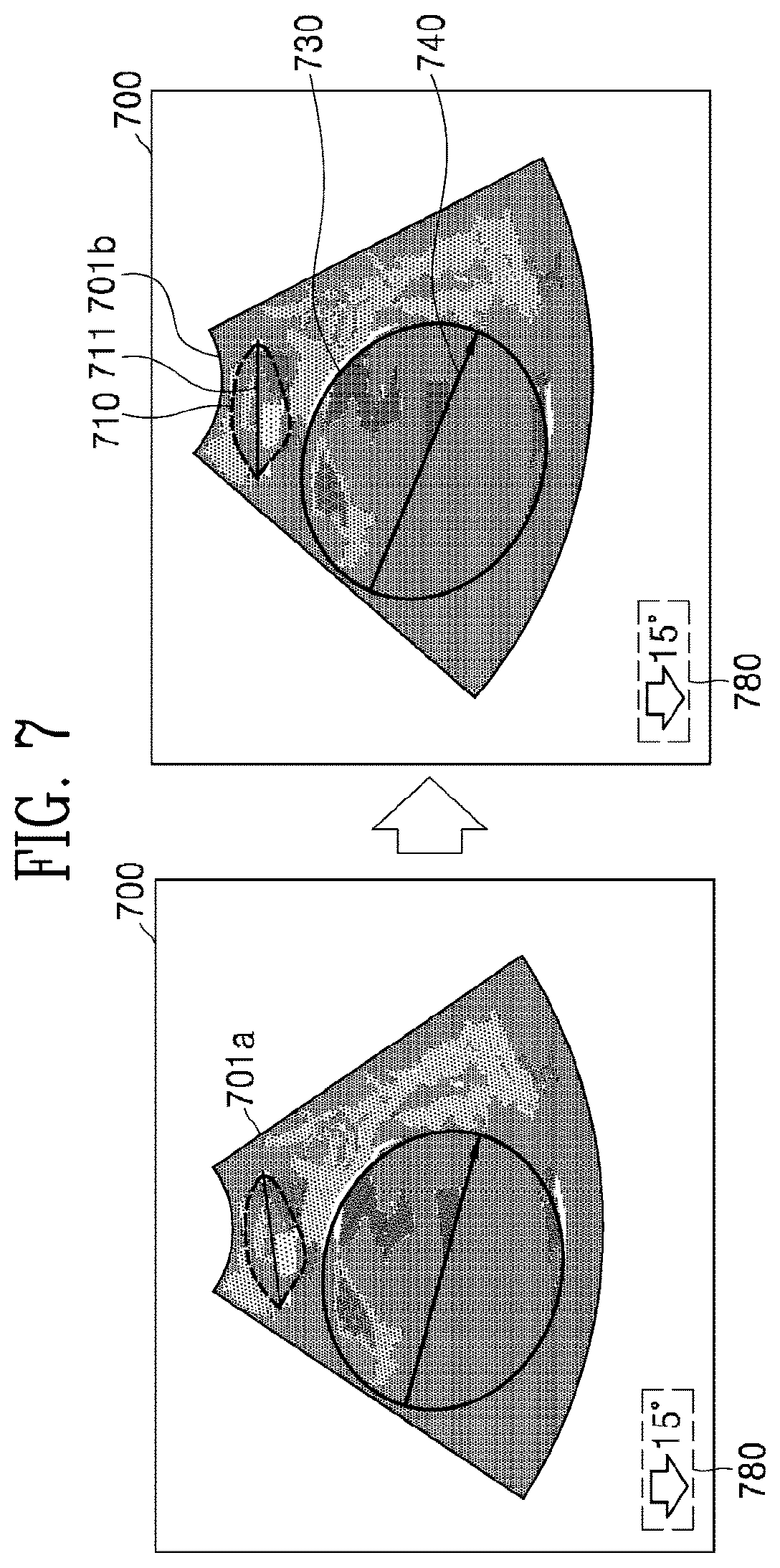 Patent US12310785 Figure 9 – Ultrasound imaging device and ultrasound image generation method for identifying degree of delivery progress of fetus