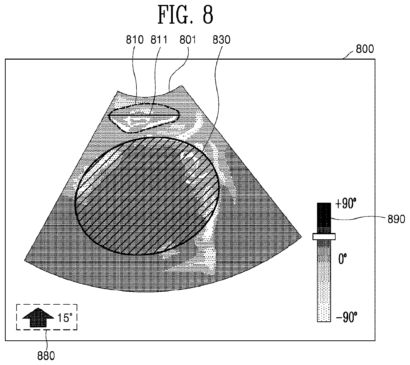Patent US12310785 Figure 10 – Ultrasound imaging device and ultrasound image generation method for identifying degree of delivery progress of fetus