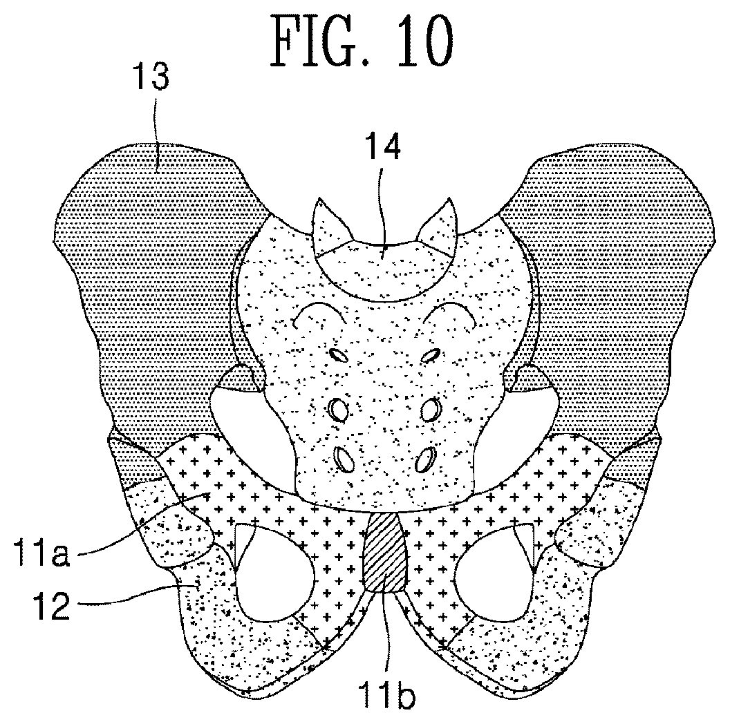 Patent US12310785 Figure 12 – Ultrasound imaging device and ultrasound image generation method for identifying degree of delivery progress of fetus