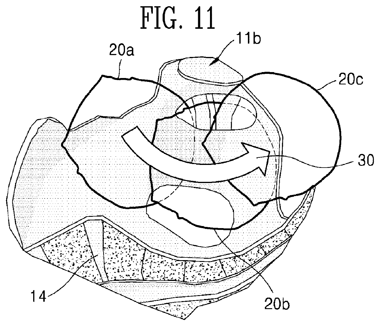 Patent US12310785 Figure 13 – Ultrasound imaging device and ultrasound image generation method for identifying degree of delivery progress of fetus