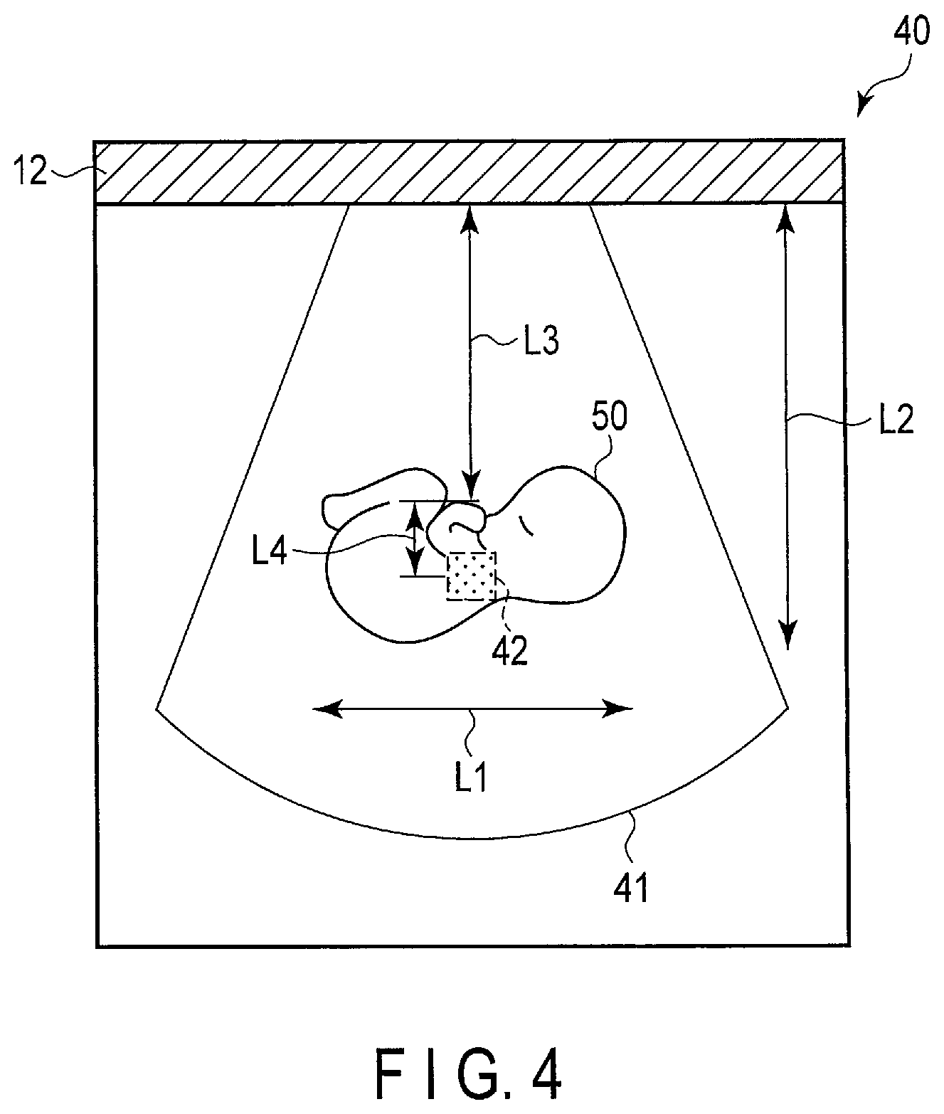 Patent US12310786 Figure 4 – Ultrasonic diagnostic apparatus and ultrasonic diagnostic method