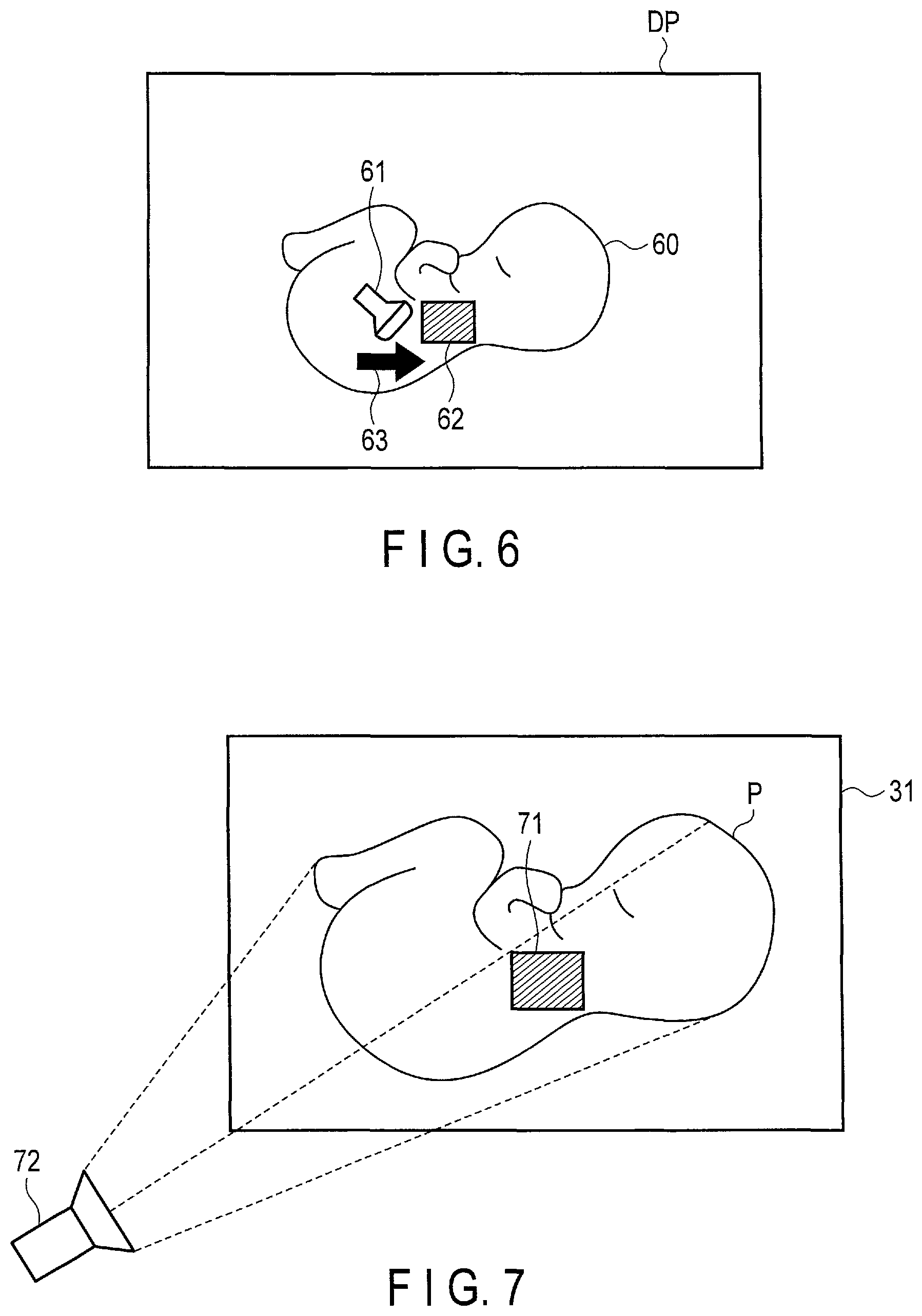 Patent US12310786 Figure 6 – Ultrasonic diagnostic apparatus and ultrasonic diagnostic method