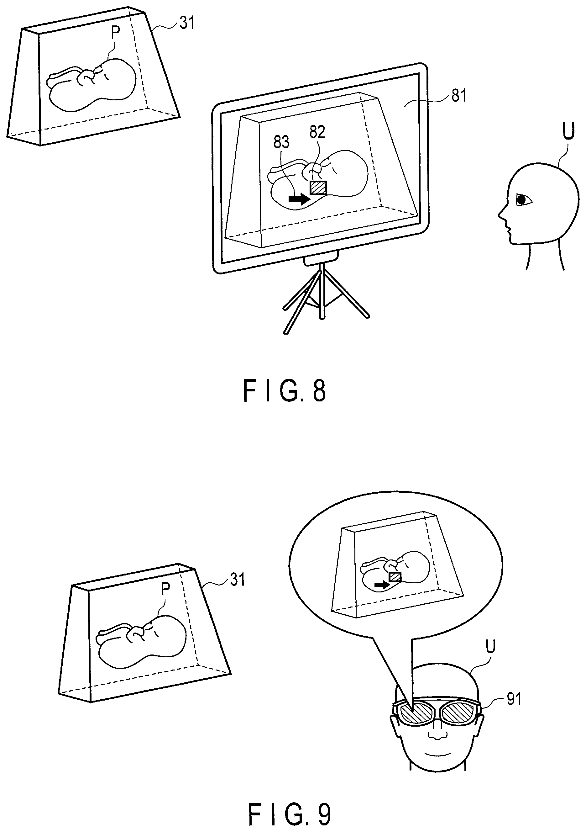 Patent US12310786 Figure 7 – Ultrasonic diagnostic apparatus and ultrasonic diagnostic method